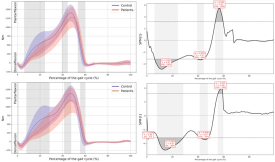 Children 13 00096 g0a13