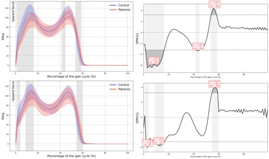 Children 13 00096 g0a14