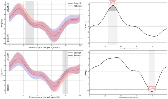 Children 13 00096 g0a2