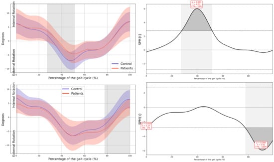 Children 13 00096 g0a3