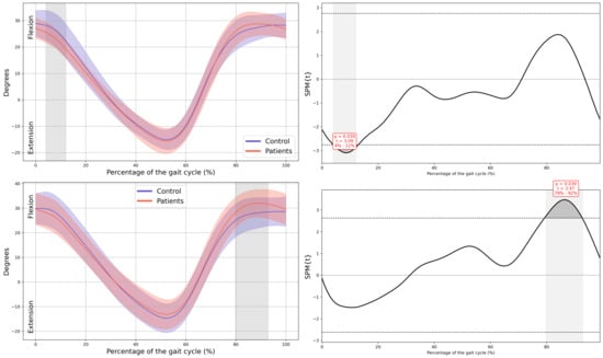 Children 13 00096 g0a4