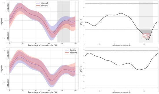 Children 13 00096 g0a5