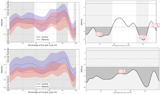 Children 13 00096 g0a6