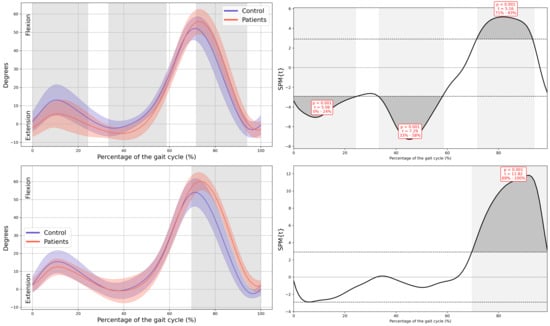 Children 13 00096 g0a7