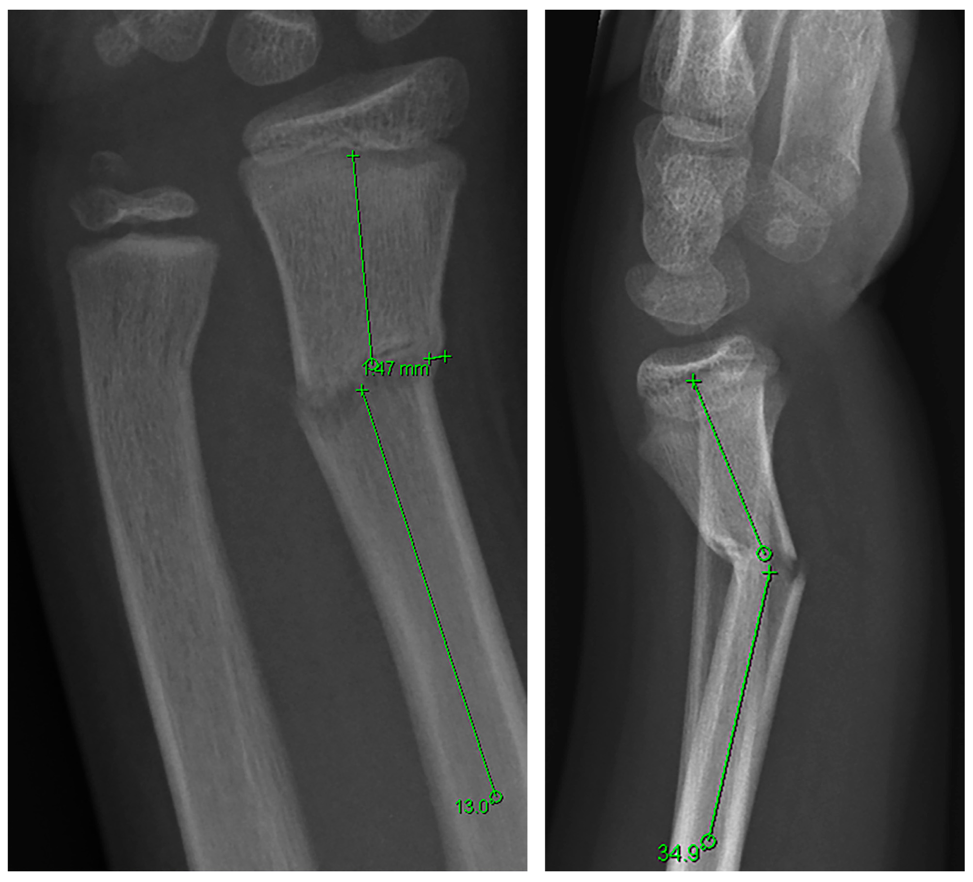 Children 13 00098 g001