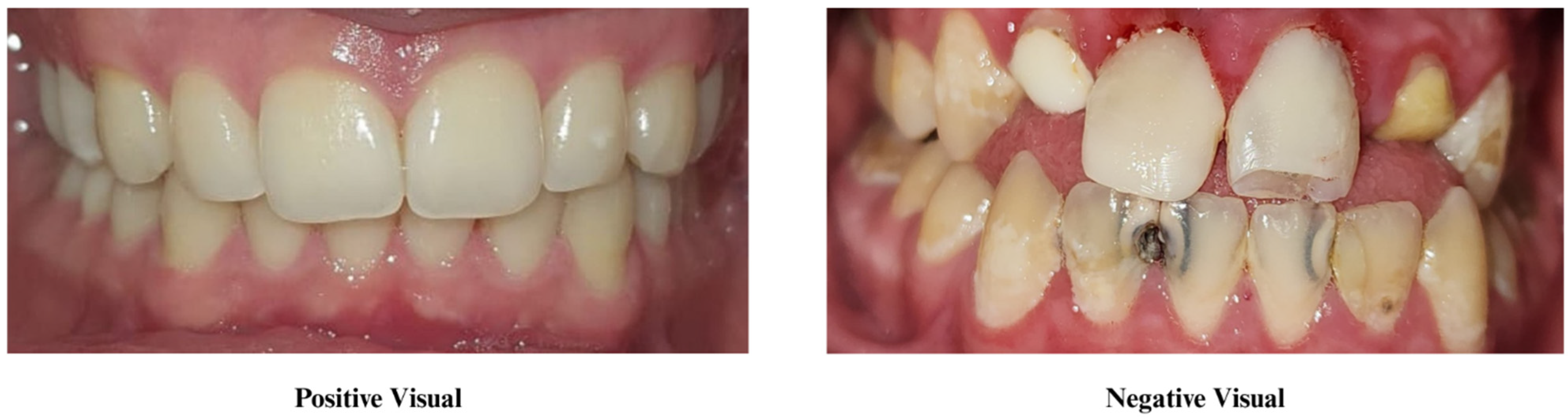 Represenative Visuals Short-Term Outcomes of Visual-Aid-Based Motivation on Children’s Oral ...