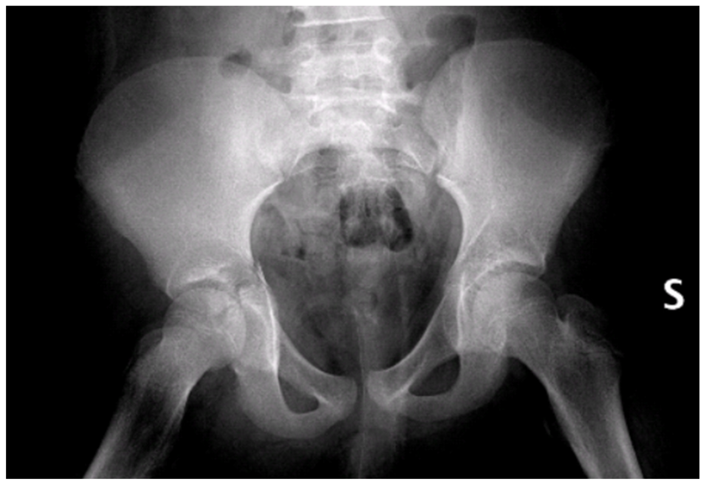 Children 13 00166 g002