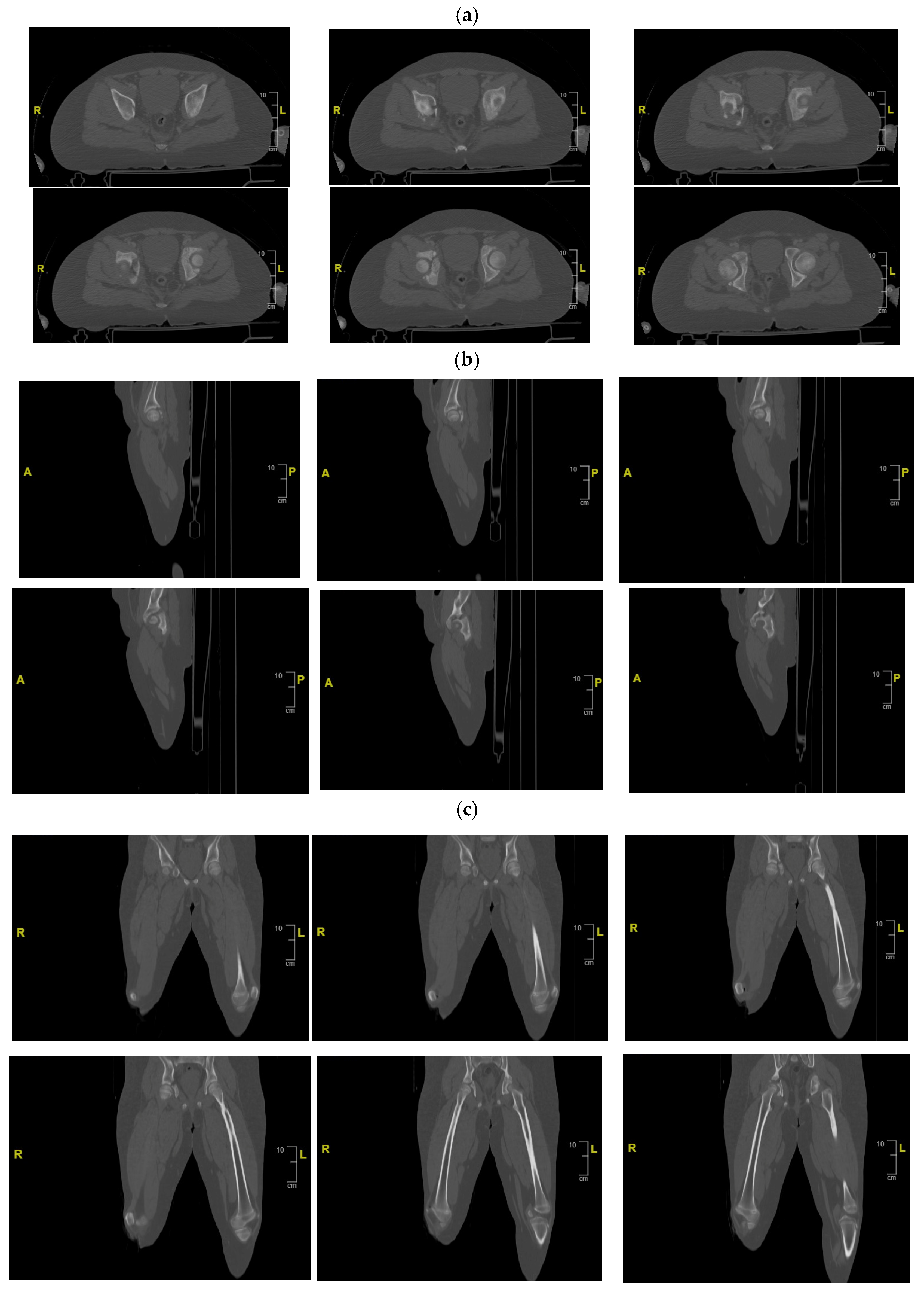 Children 13 00166 g003