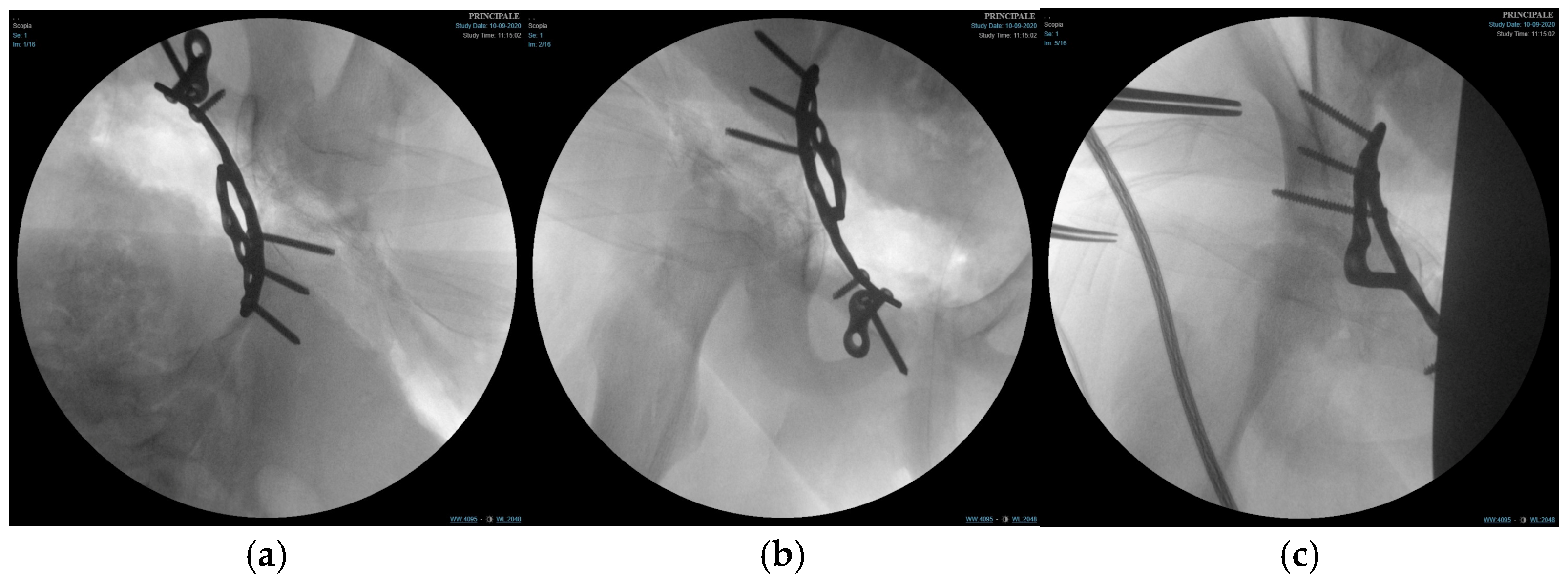 Children 13 00166 g004