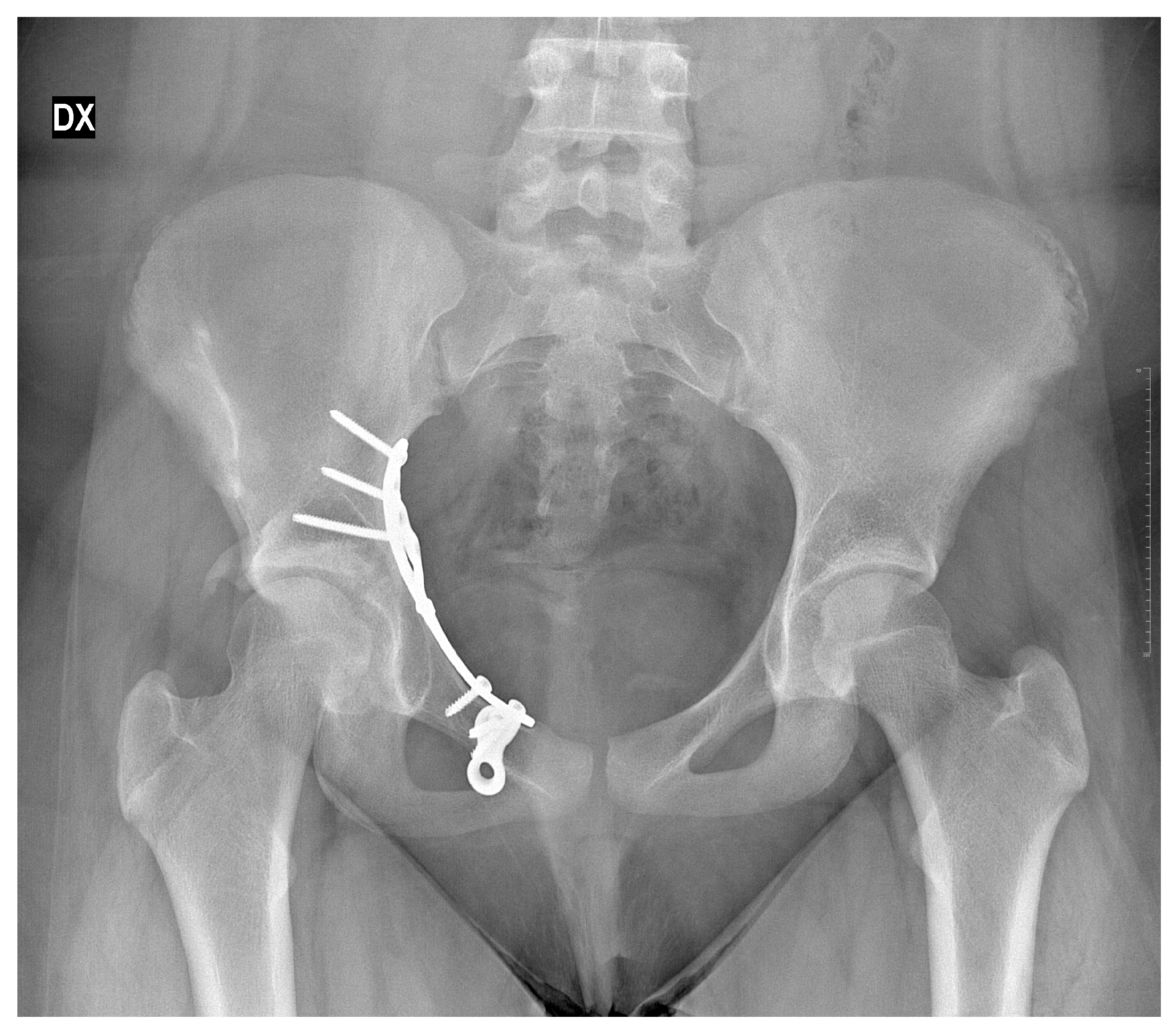 Children 13 00166 g007