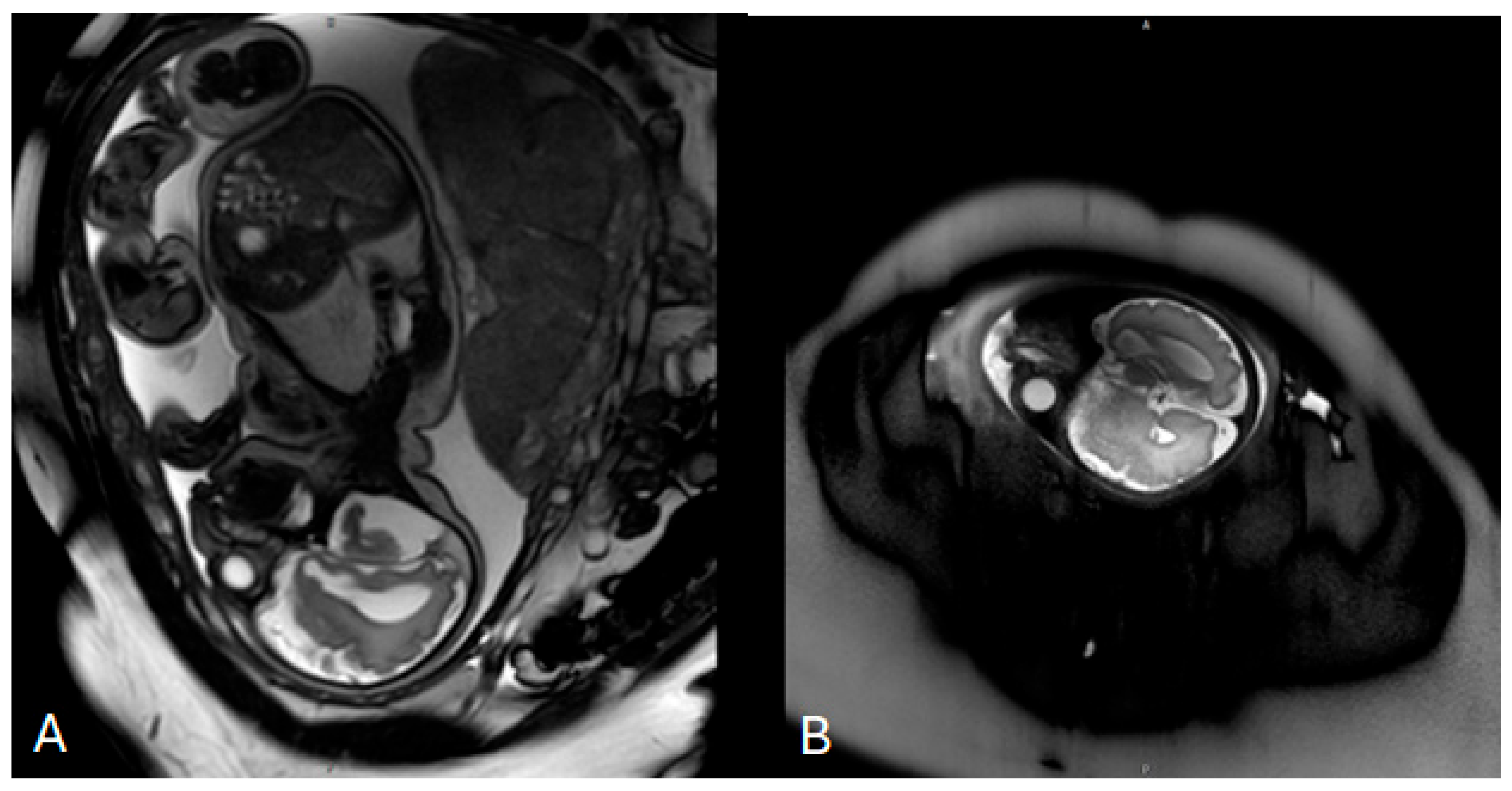 Children 13 00202 g001 Children 13 00202 g001