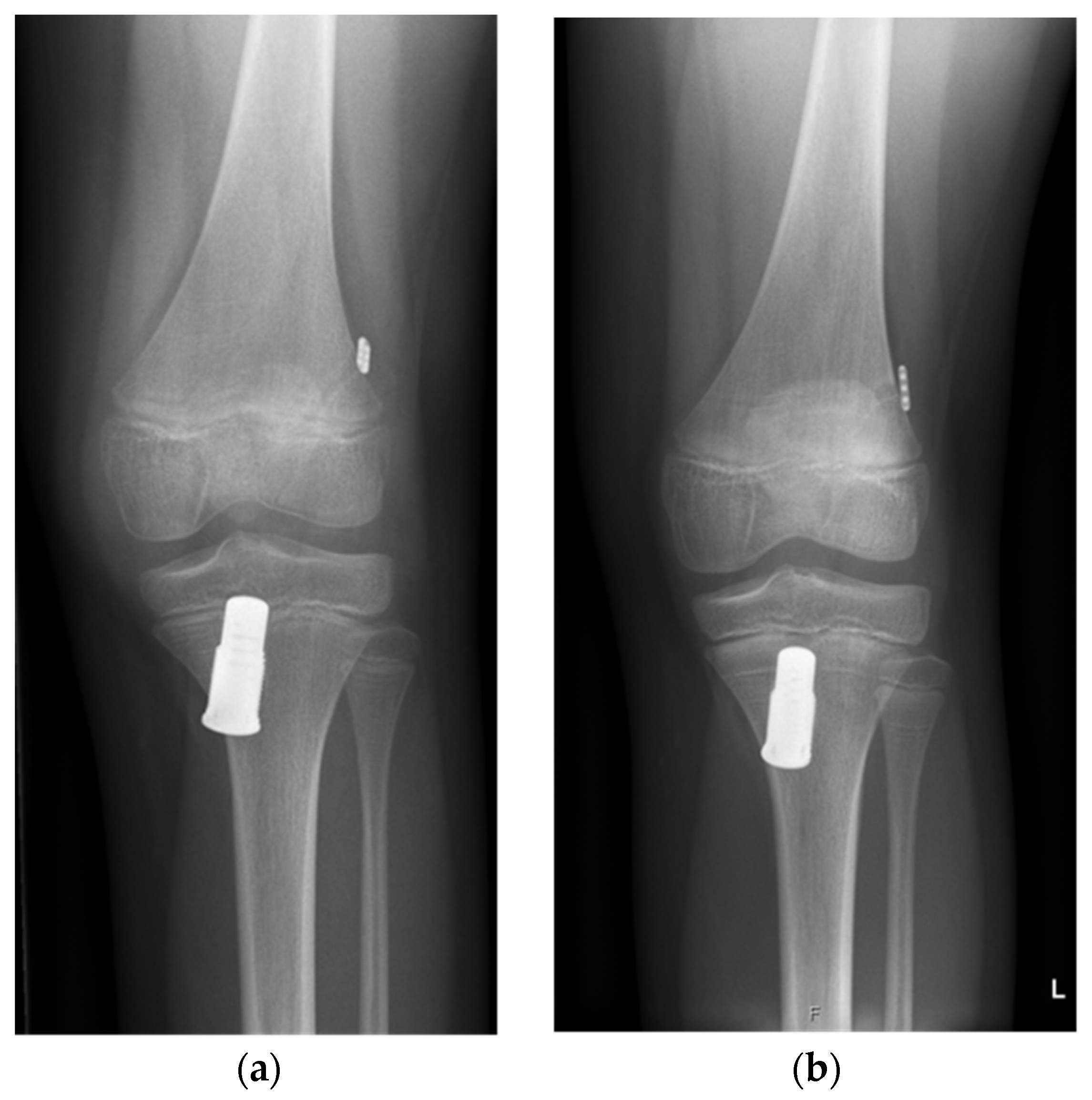 Children 13 00393 g001