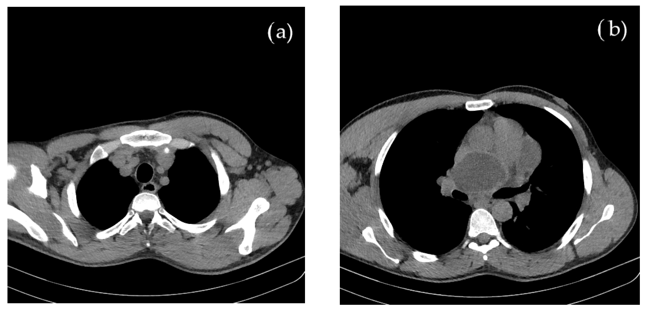 Cimb 45 00170 g002 Cimb 45 00170 g002