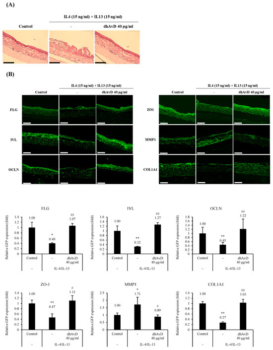 Normalizer Function Dihydroavenanthramide D Enhances Skin Barrier Function through ...