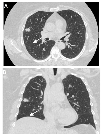 Clinpract 11 00056 i001