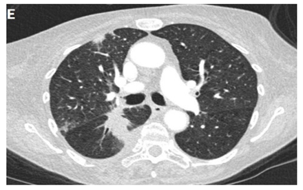 Clinpract 11 00056 i004