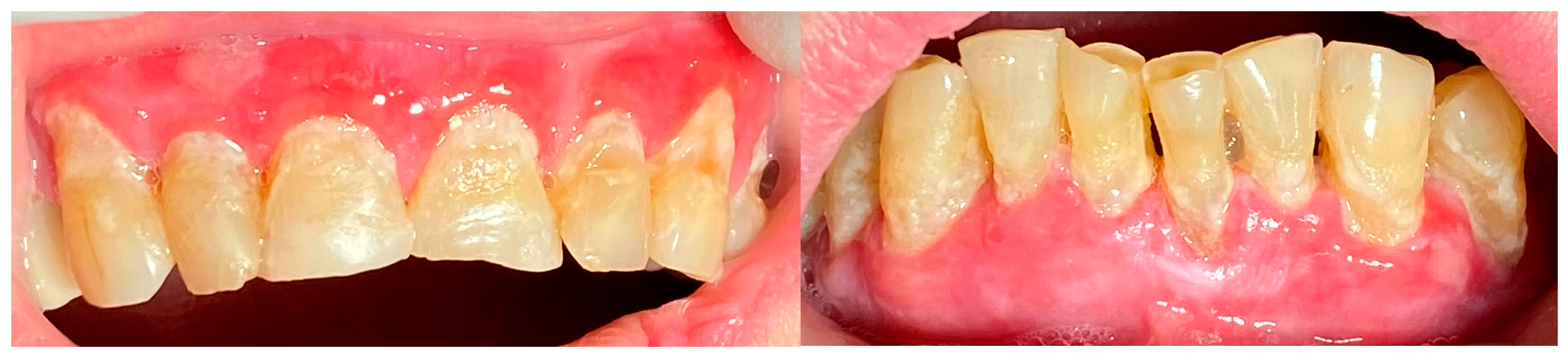 Clinpract 14 00153 g002 Clinpract 14 00153 g002