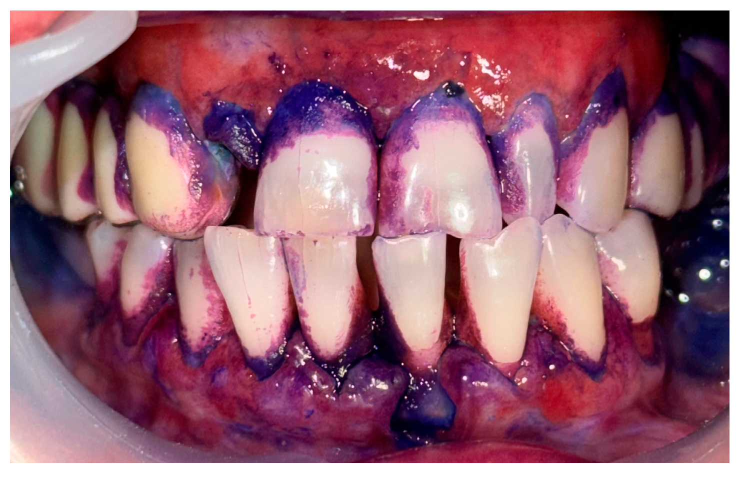 Clinpract 14 00153 g009 Clinpract 14 00153 g009