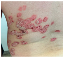 Clinpract 14 00168 i001