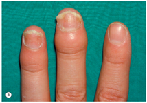 Clinpract 14 00168 i003