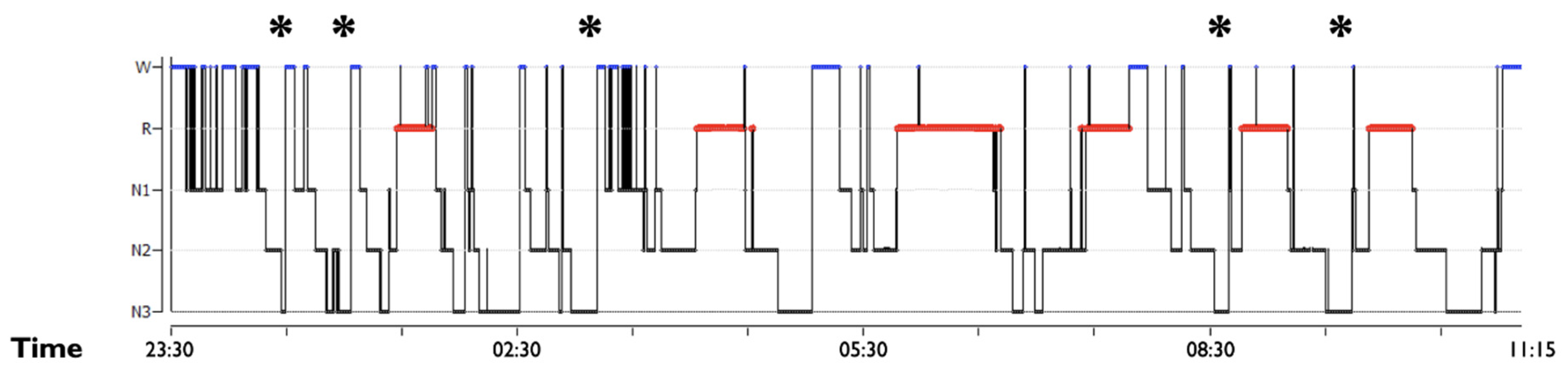 Clockssleep 03 00004 g002