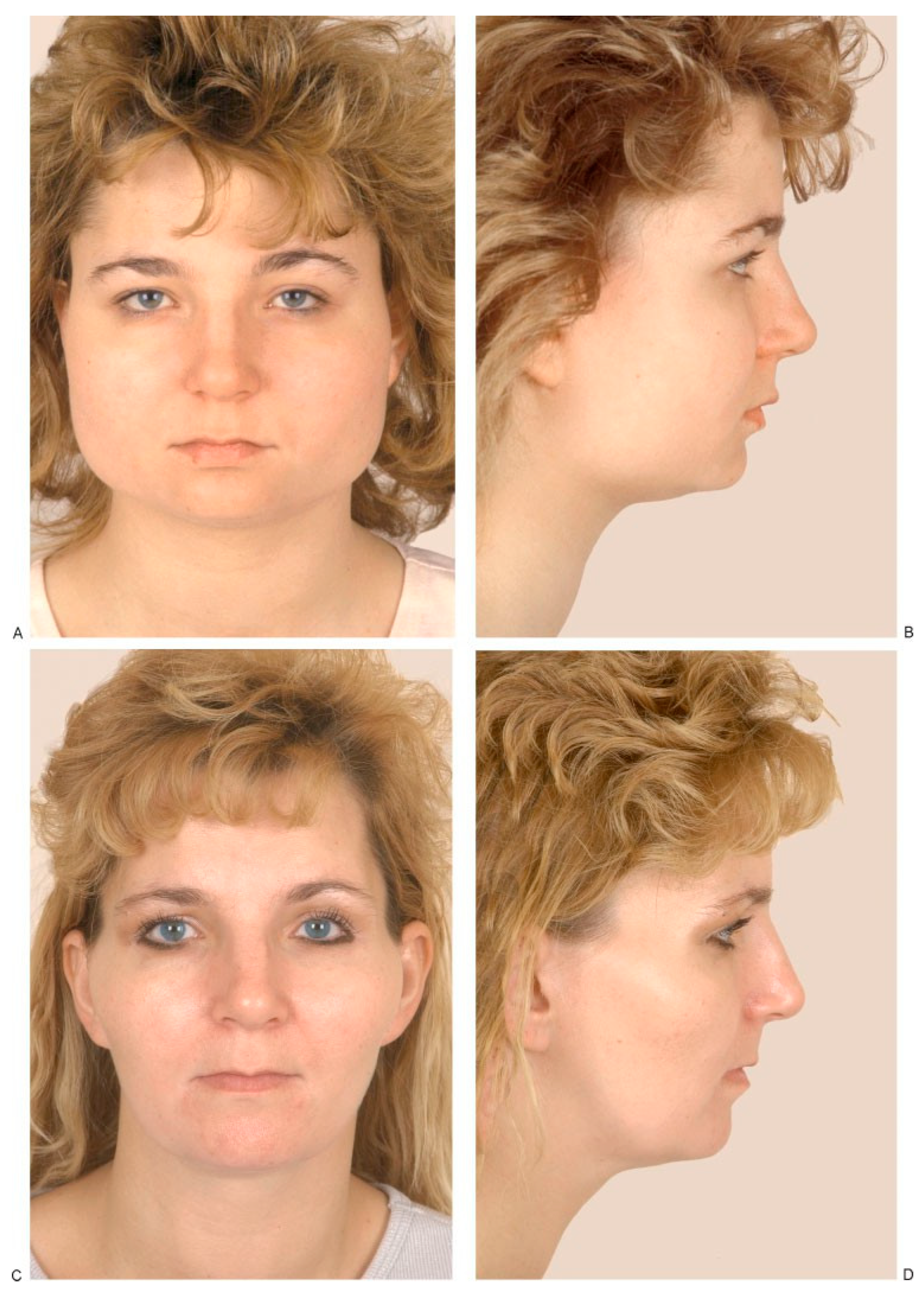 Cmtr 02 00015 g001a Cmtr 02 00015 g001a