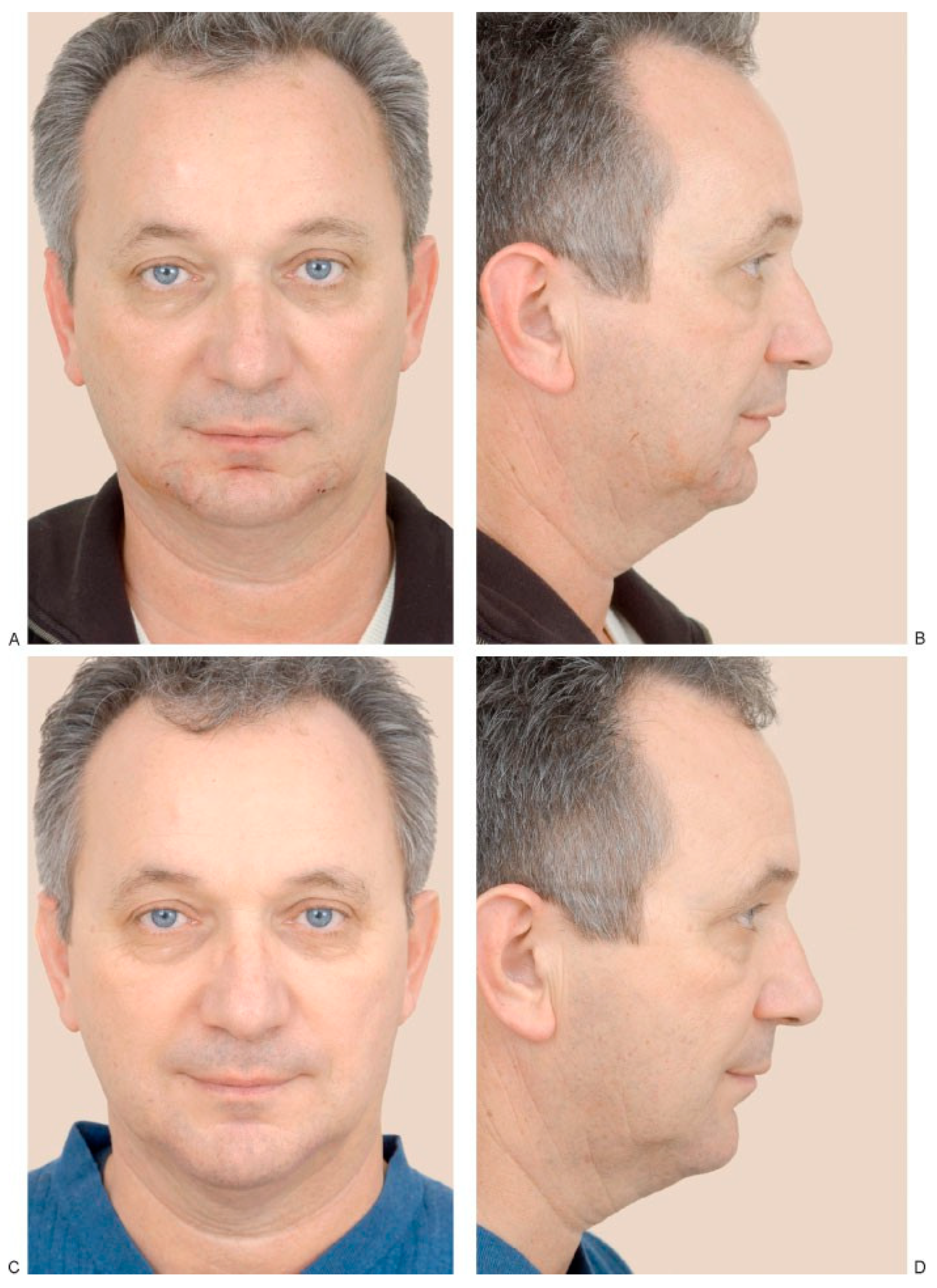 Cmtr 02 00015 g002 Cmtr 02 00015 g002