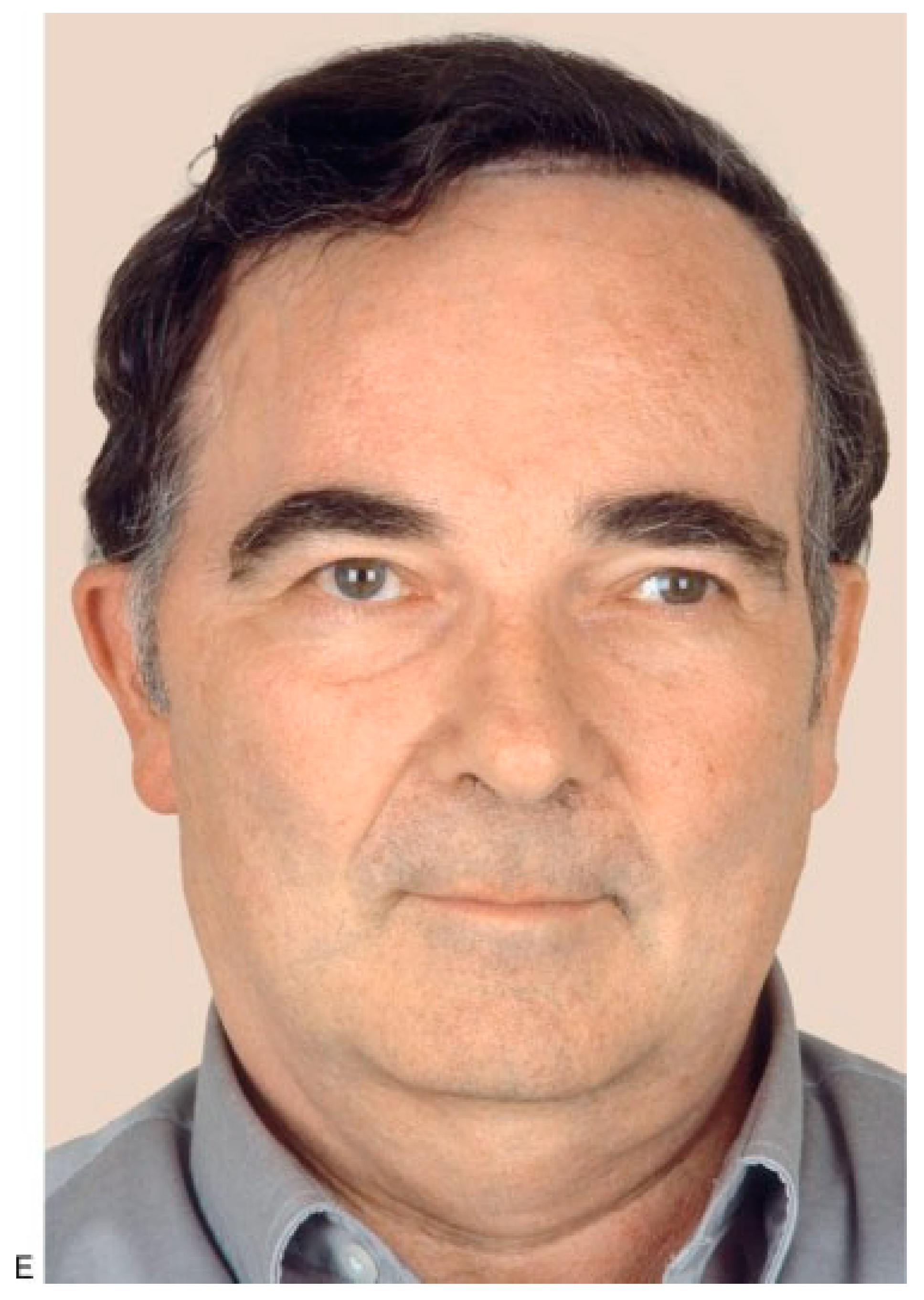 Cmtr 02 00015 g004b Cmtr 02 00015 g004b