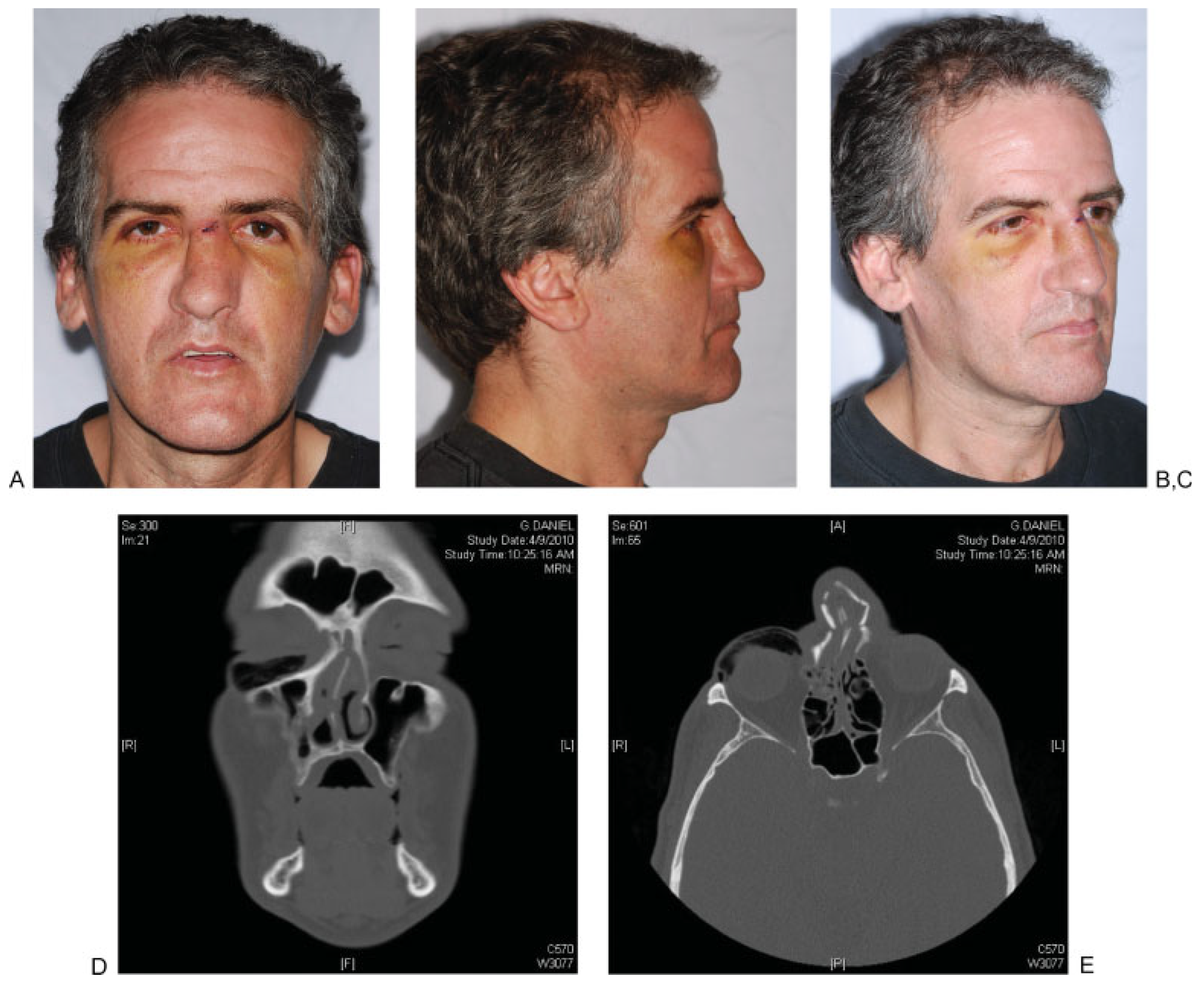 Cmtr 05 v5i2f99 g001