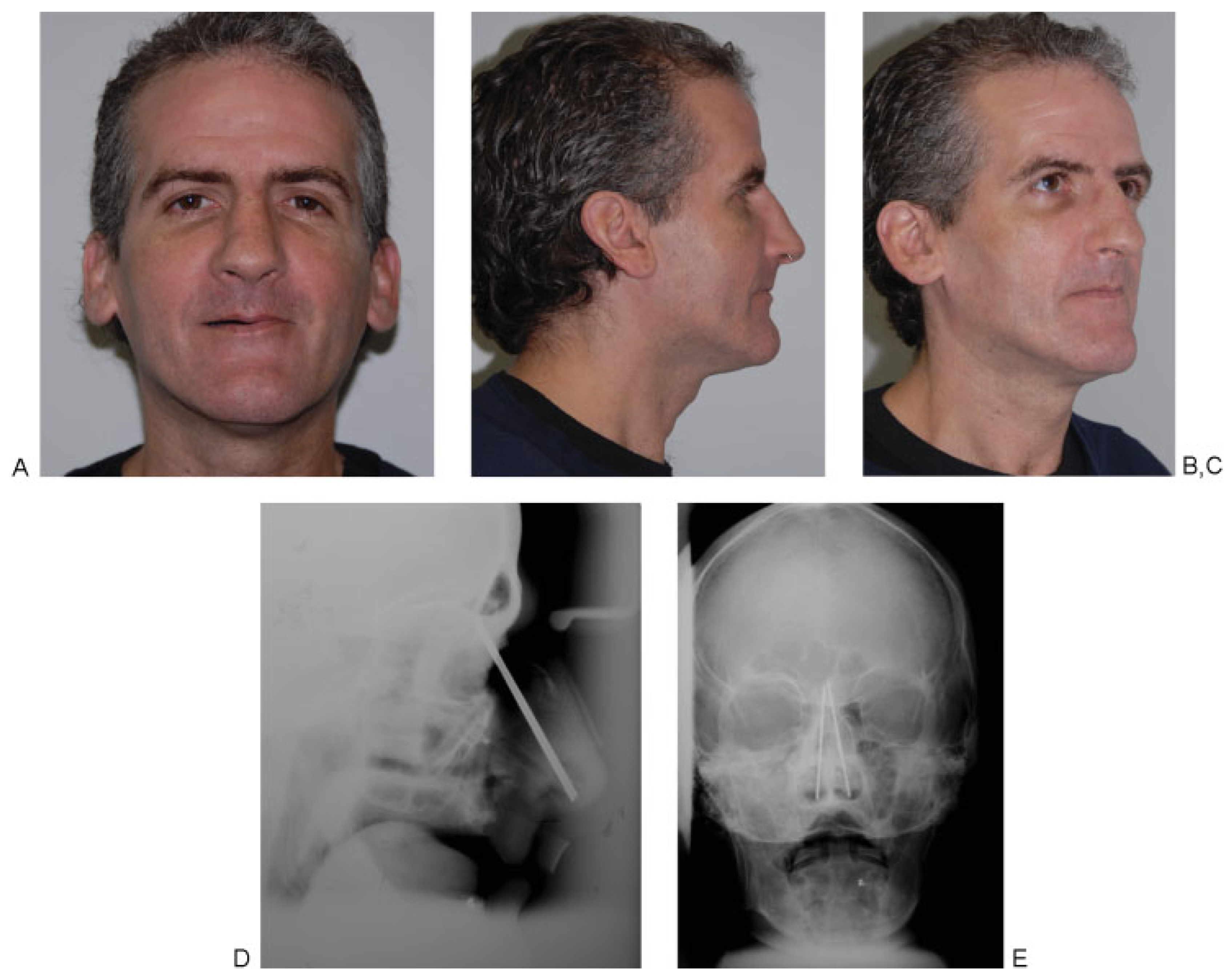 Cmtr 05 v5i2f99 g002