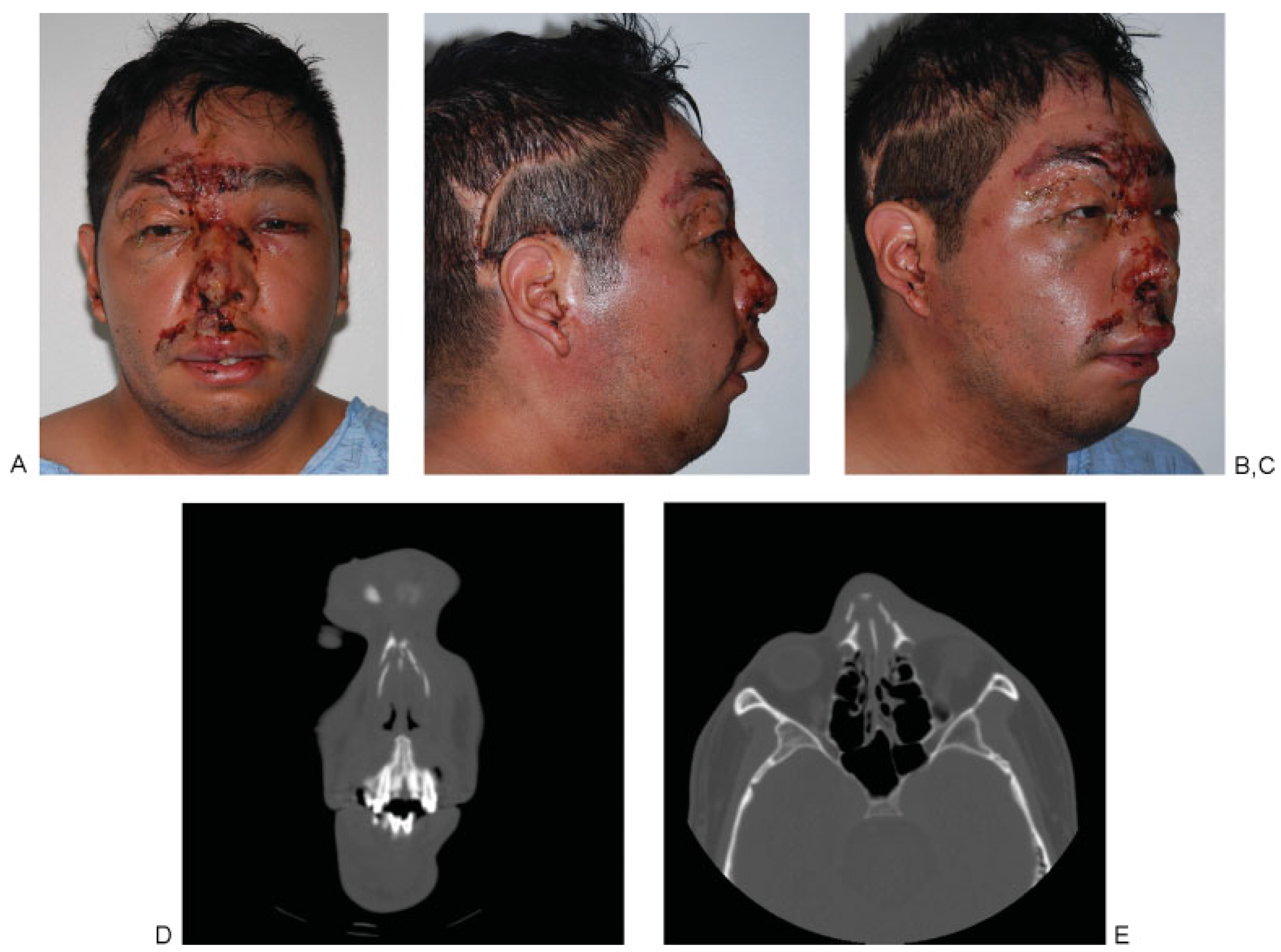 Cmtr 05 v5i2f99 g005