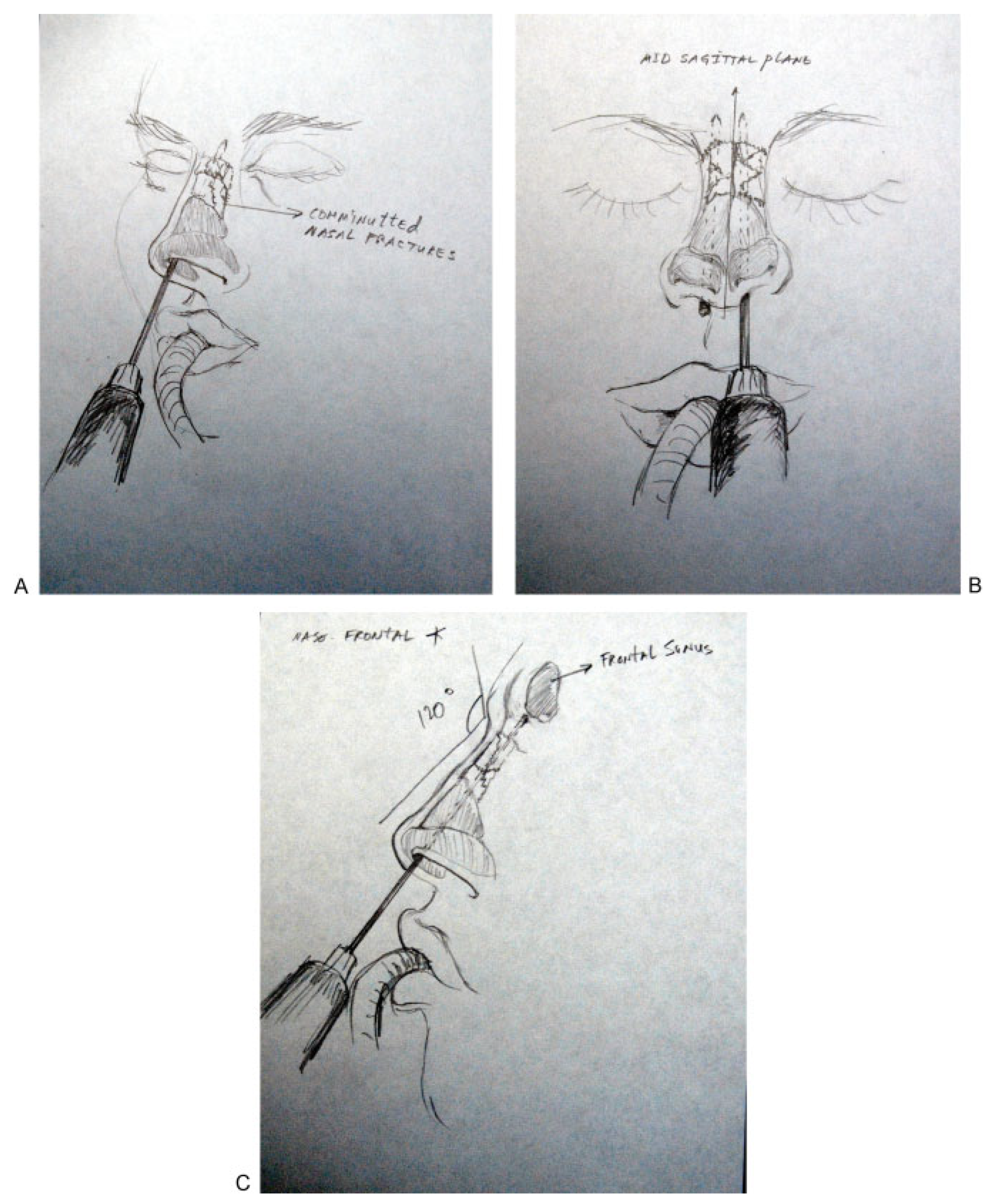 Cmtr 05 v5i2f99 g007