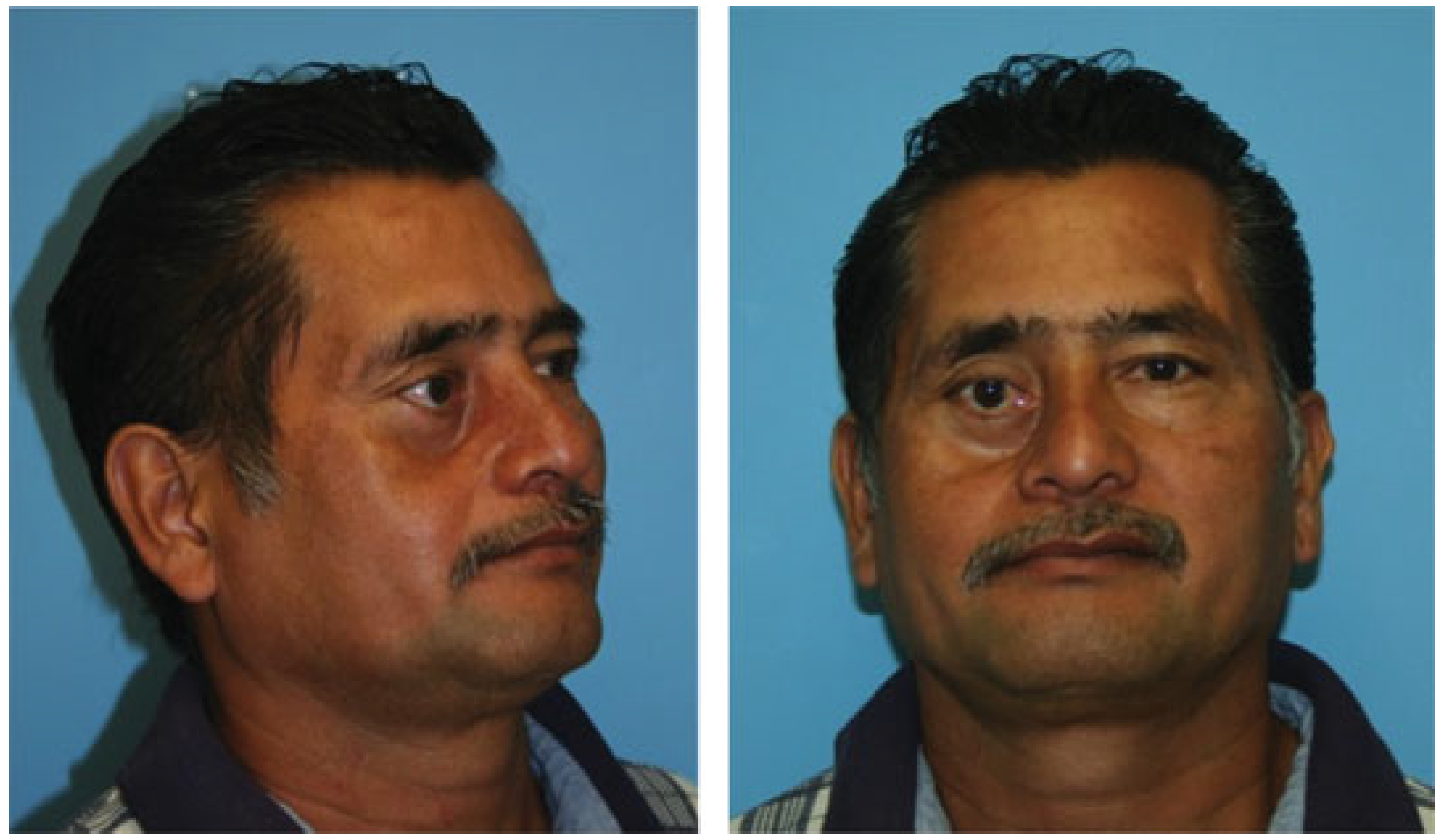 Cmtr 06 00046 g001 Cmtr 06 00046 g001