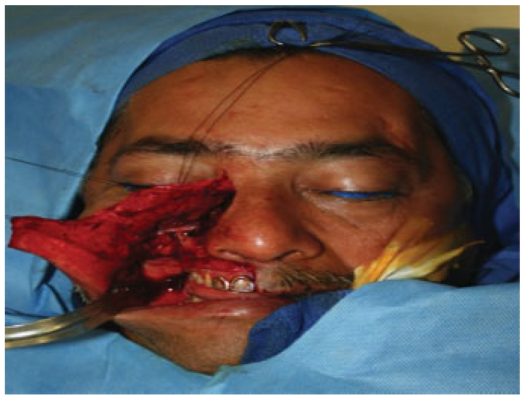 Cmtr 06 00046 g004 Cmtr 06 00046 g004