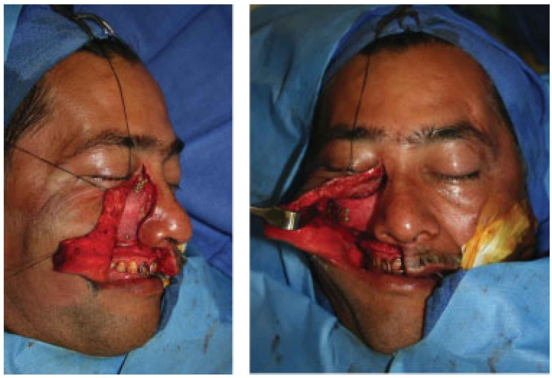 Cmtr 06 00046 g006 Cmtr 06 00046 g006