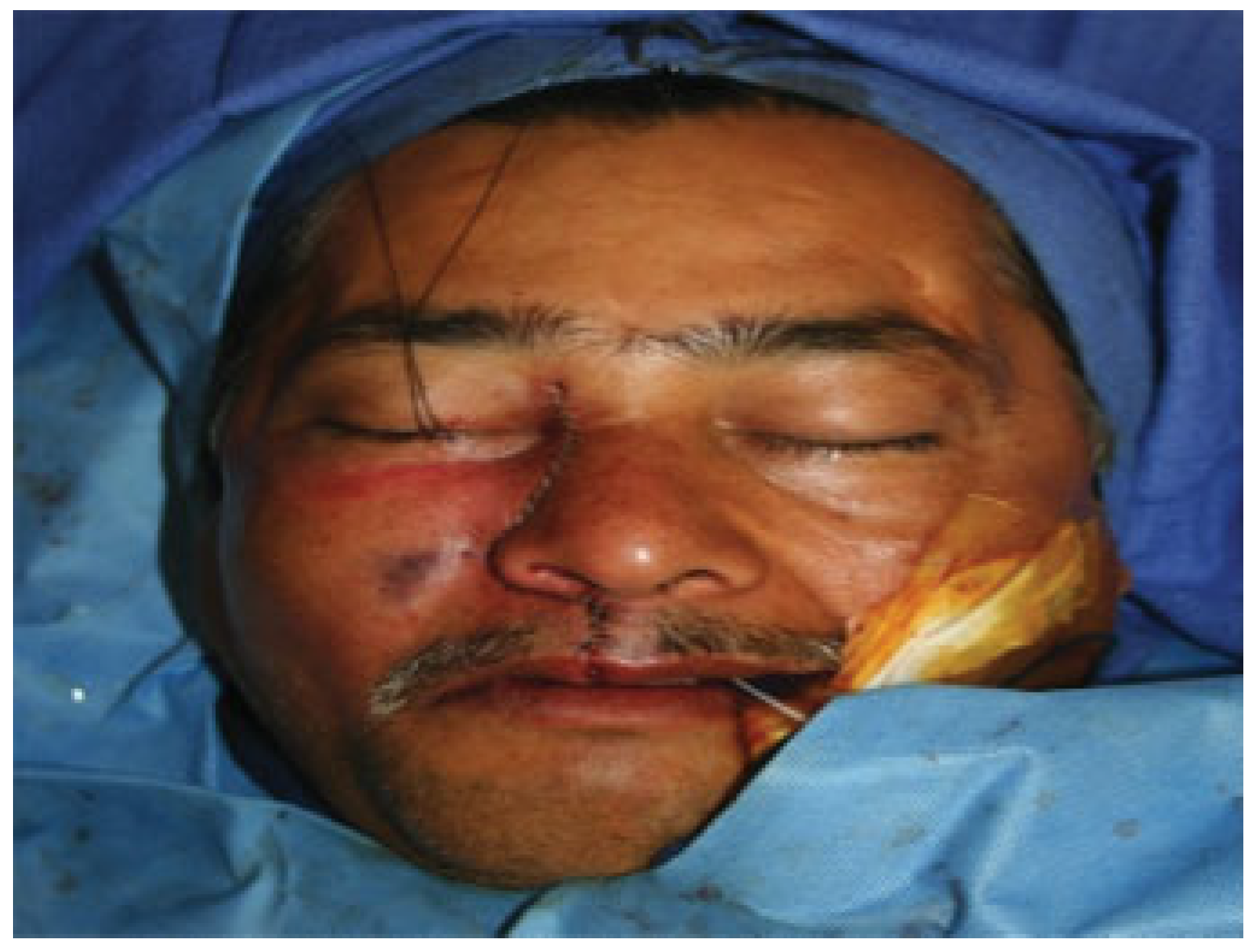 Cmtr 06 00046 g007 Cmtr 06 00046 g007