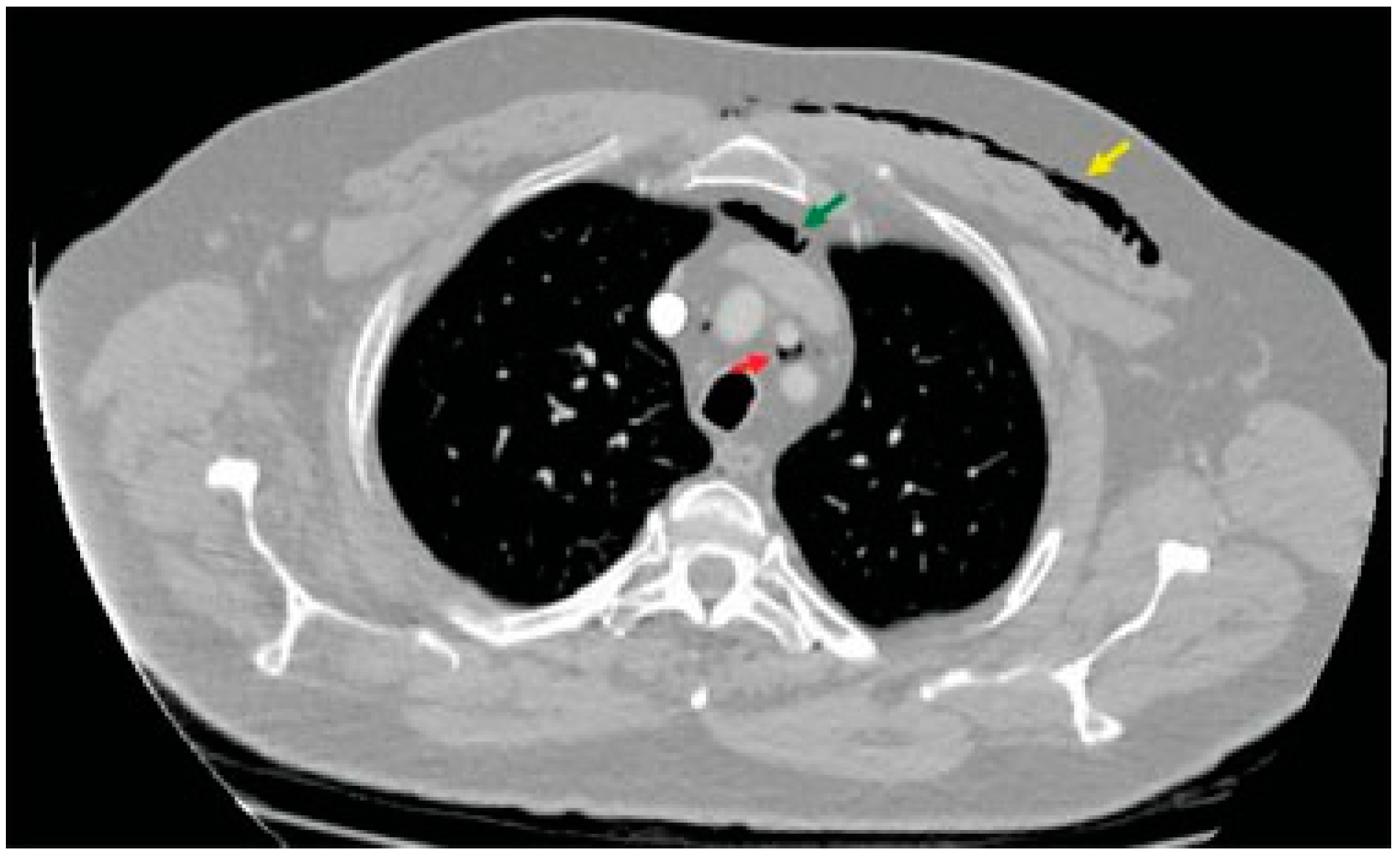 Cmtr 12 00010 g003 Cmtr 12 00010 g003