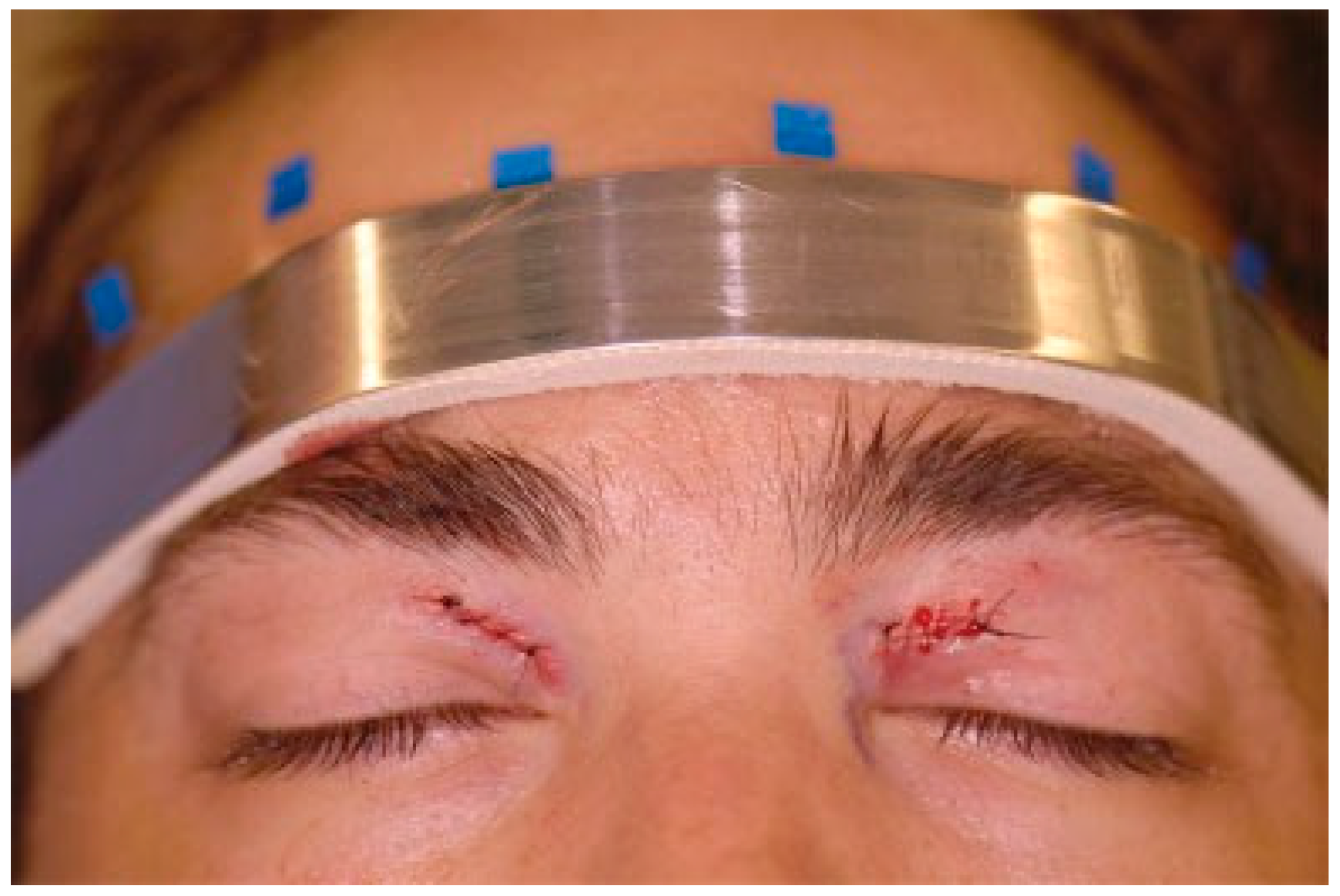 Cmtr 12 00013 g004 Cmtr 12 00013 g004