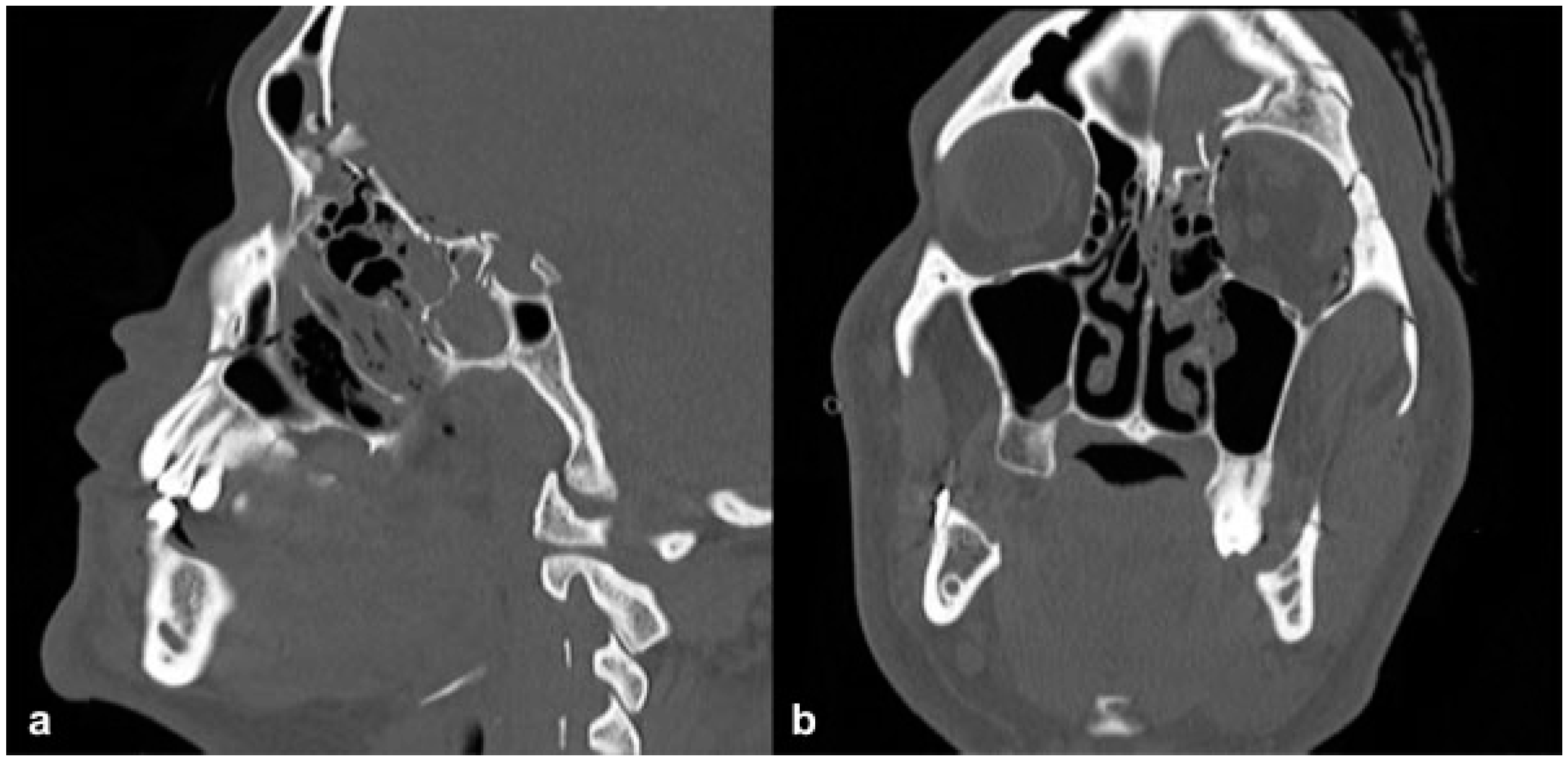 Cmtr 12 00013 g005 Cmtr 12 00013 g005