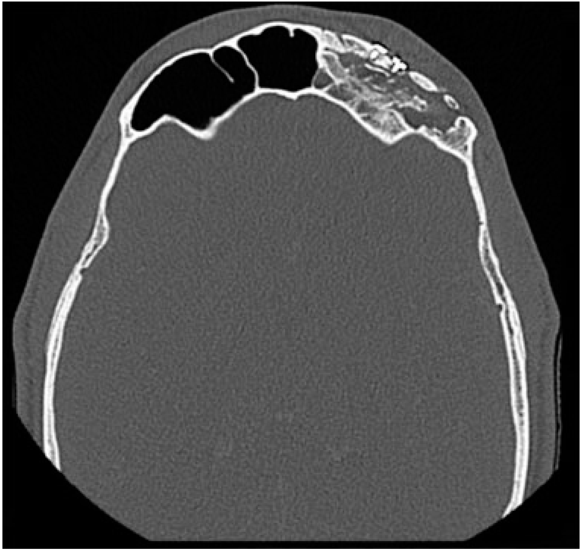 Cmtr 12 00013 g008 Cmtr 12 00013 g008