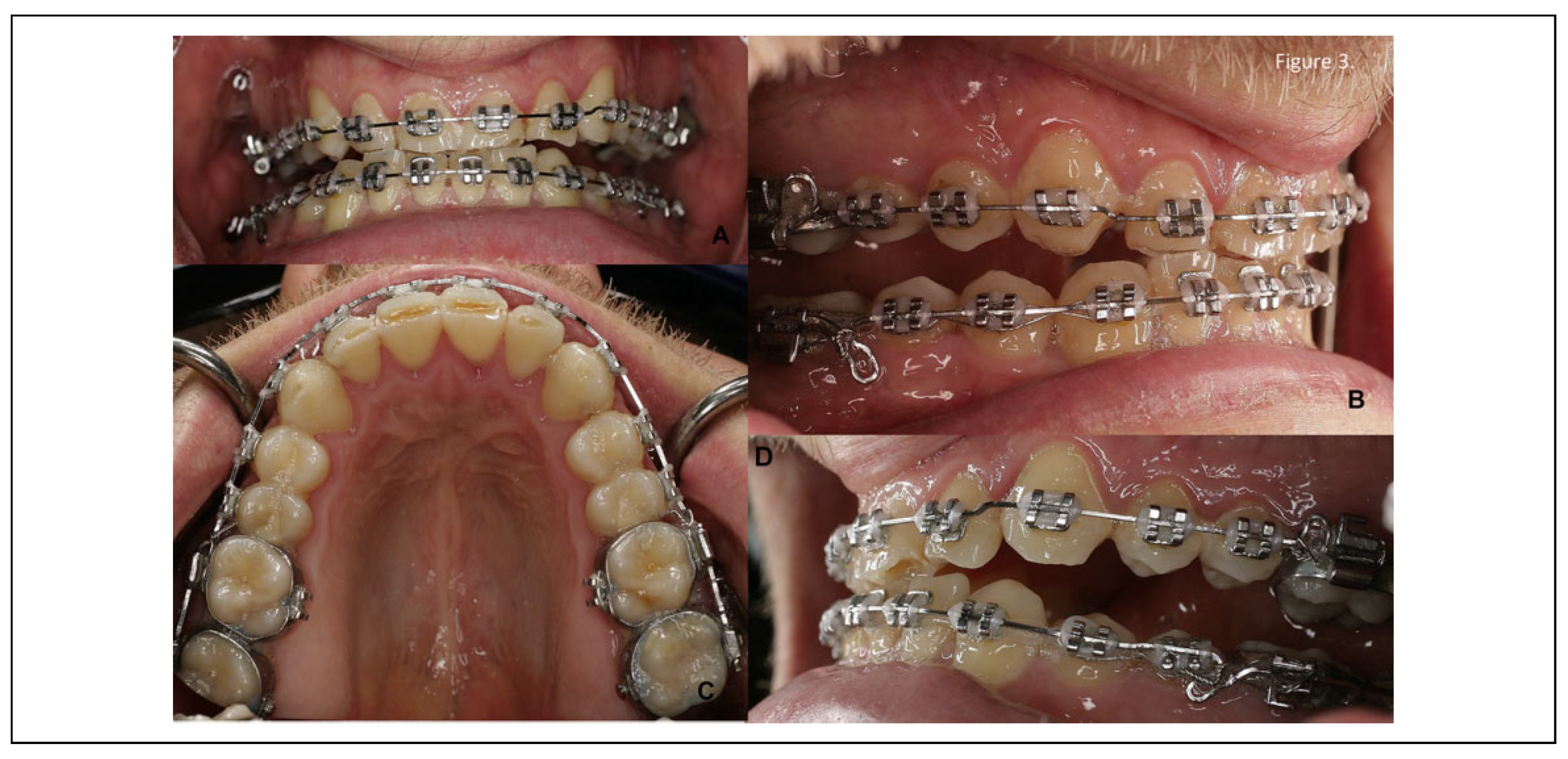 Cmtr 13 00034 g003 Cmtr 13 00034 g003