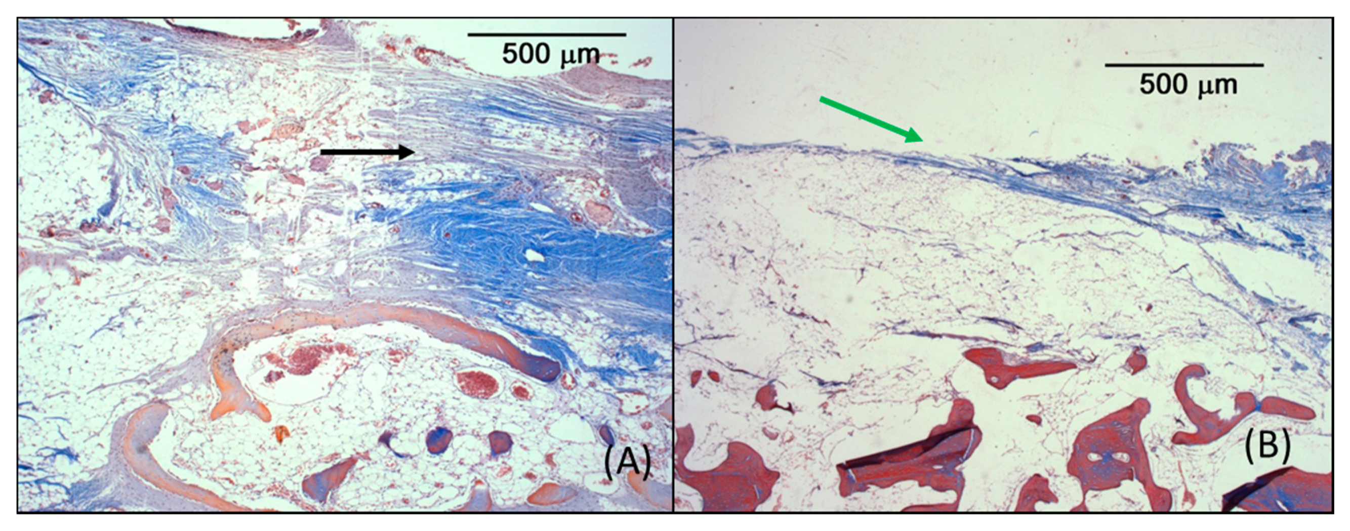 Coatings 10 00595 g007