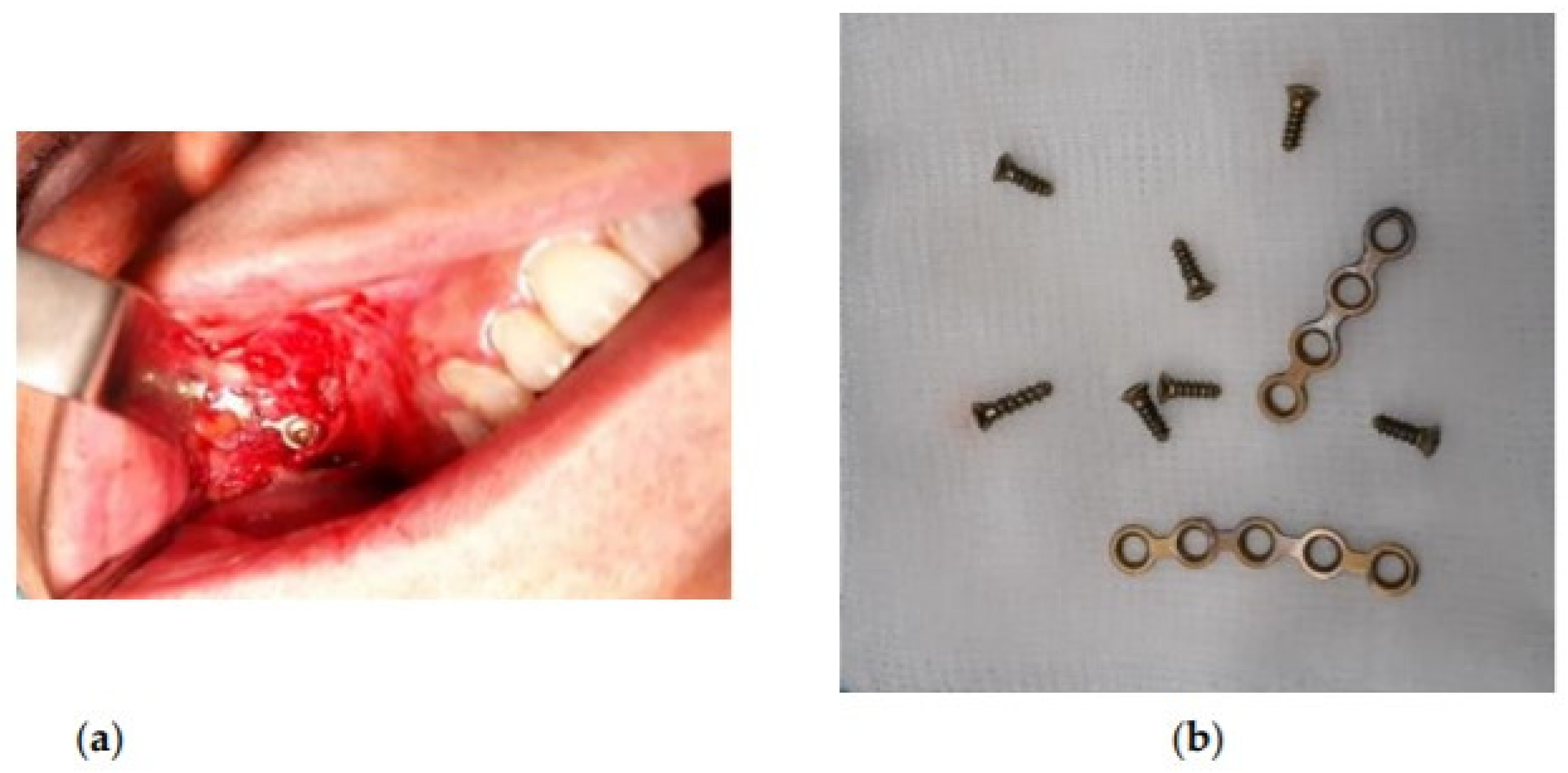 Coatings 12 00214 g001 Coatings 12 00214 g001