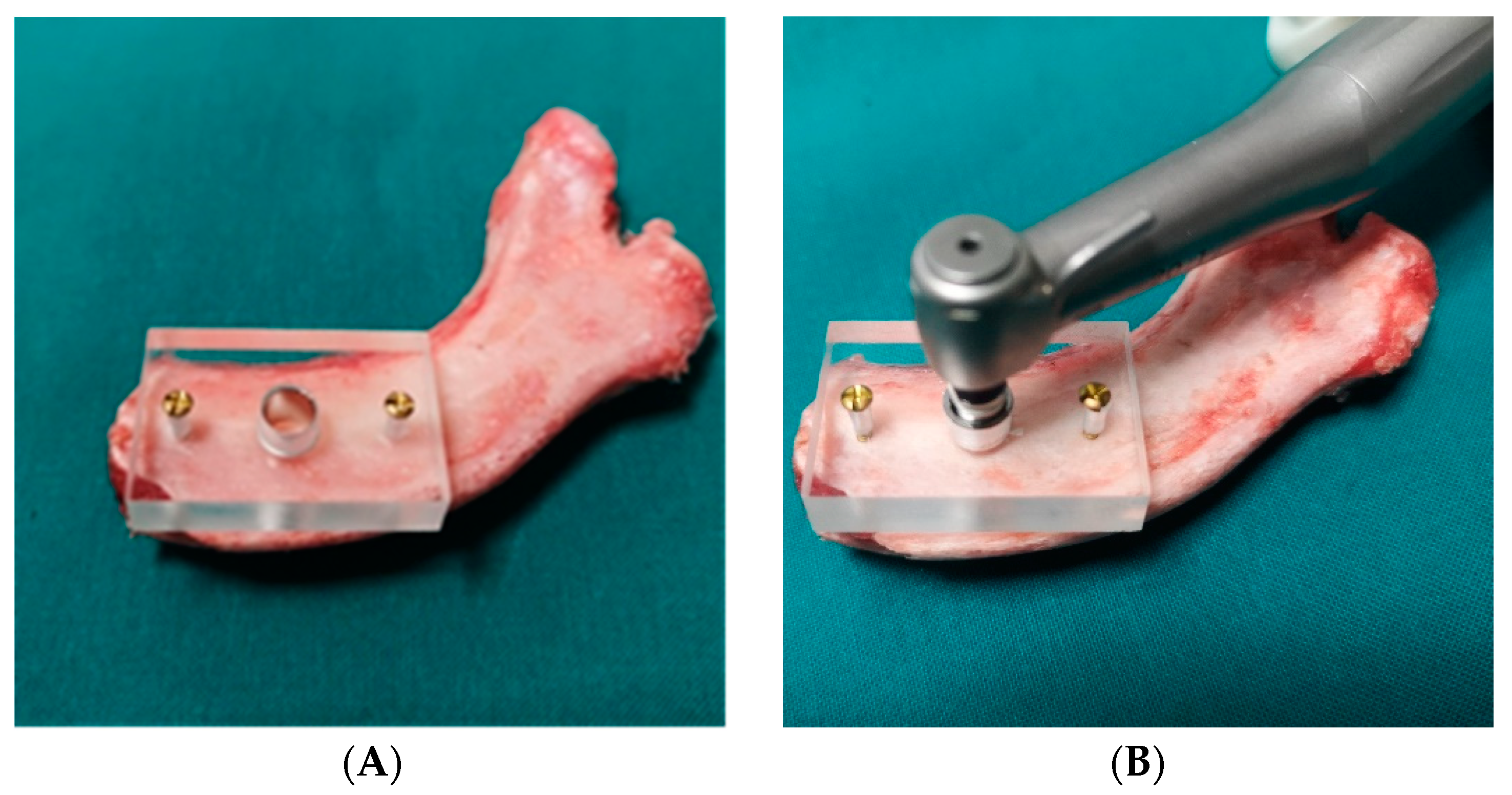 Coatings 12 00240 g003