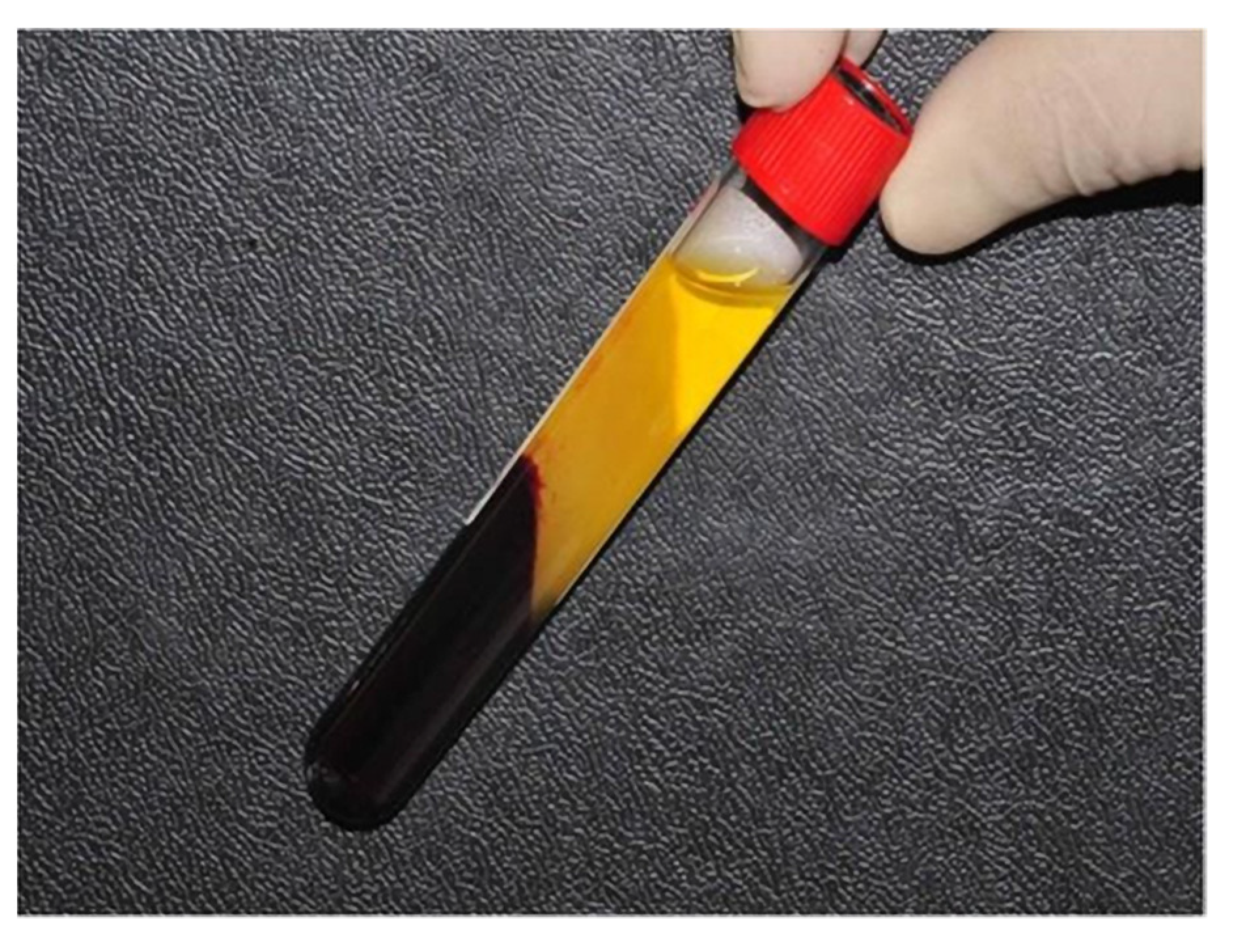 Coatings 12 00247 g001