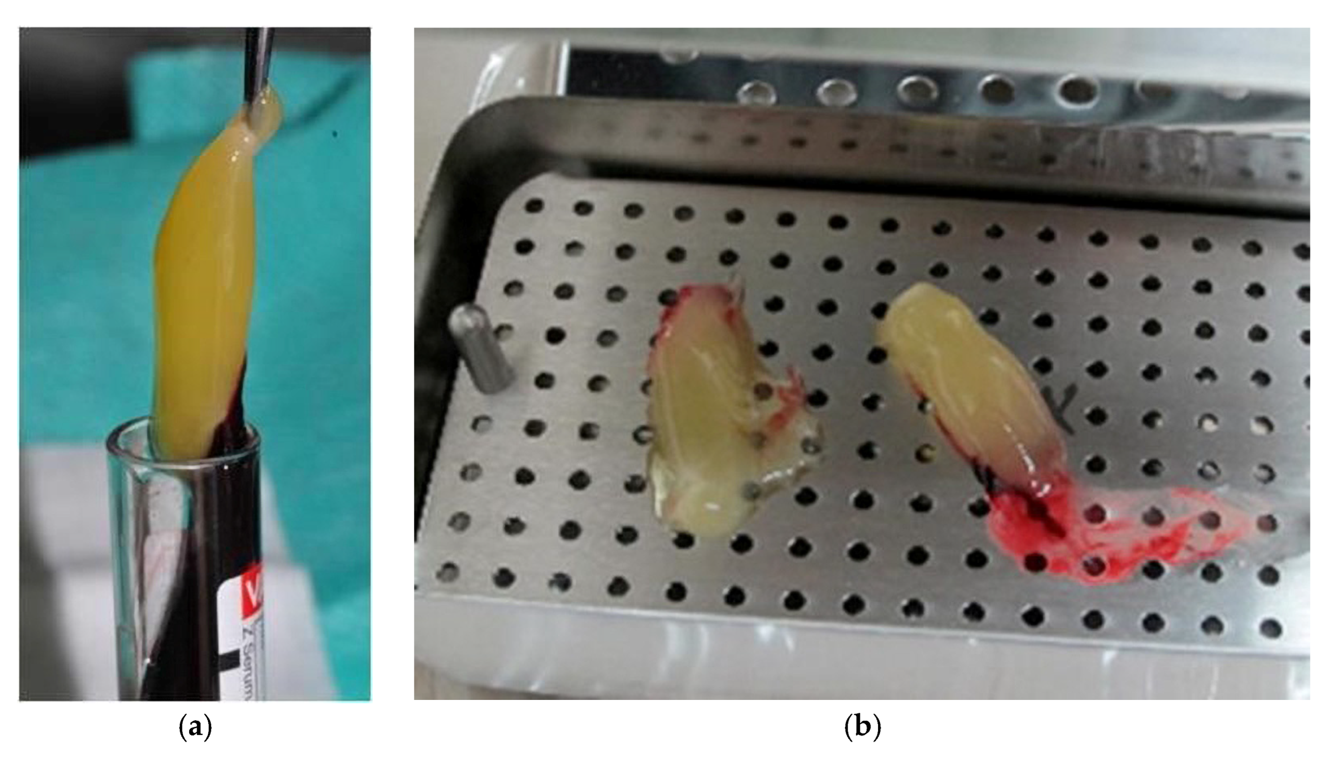 Coatings 12 00247 g002