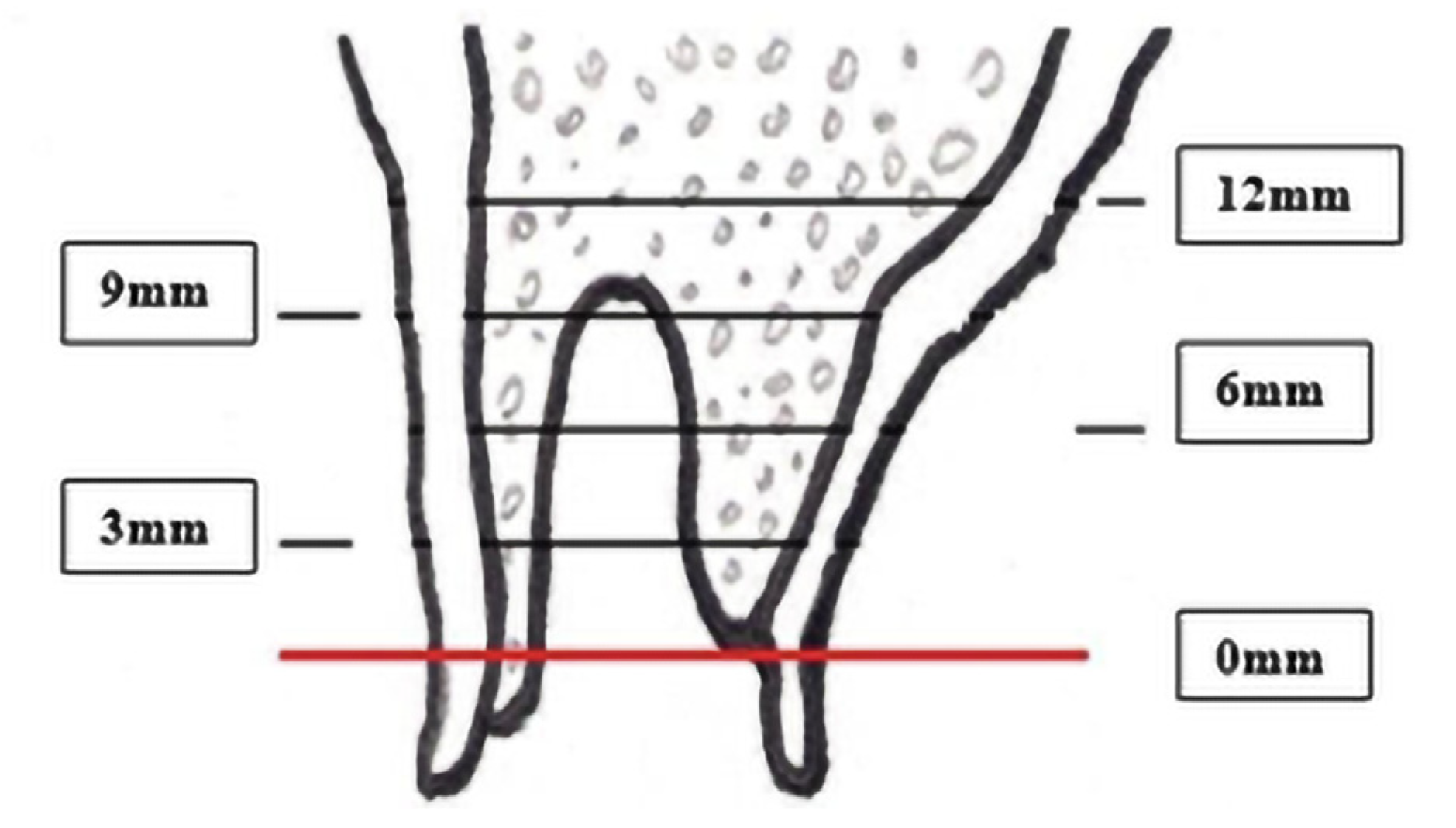 Coatings 12 00247 g003