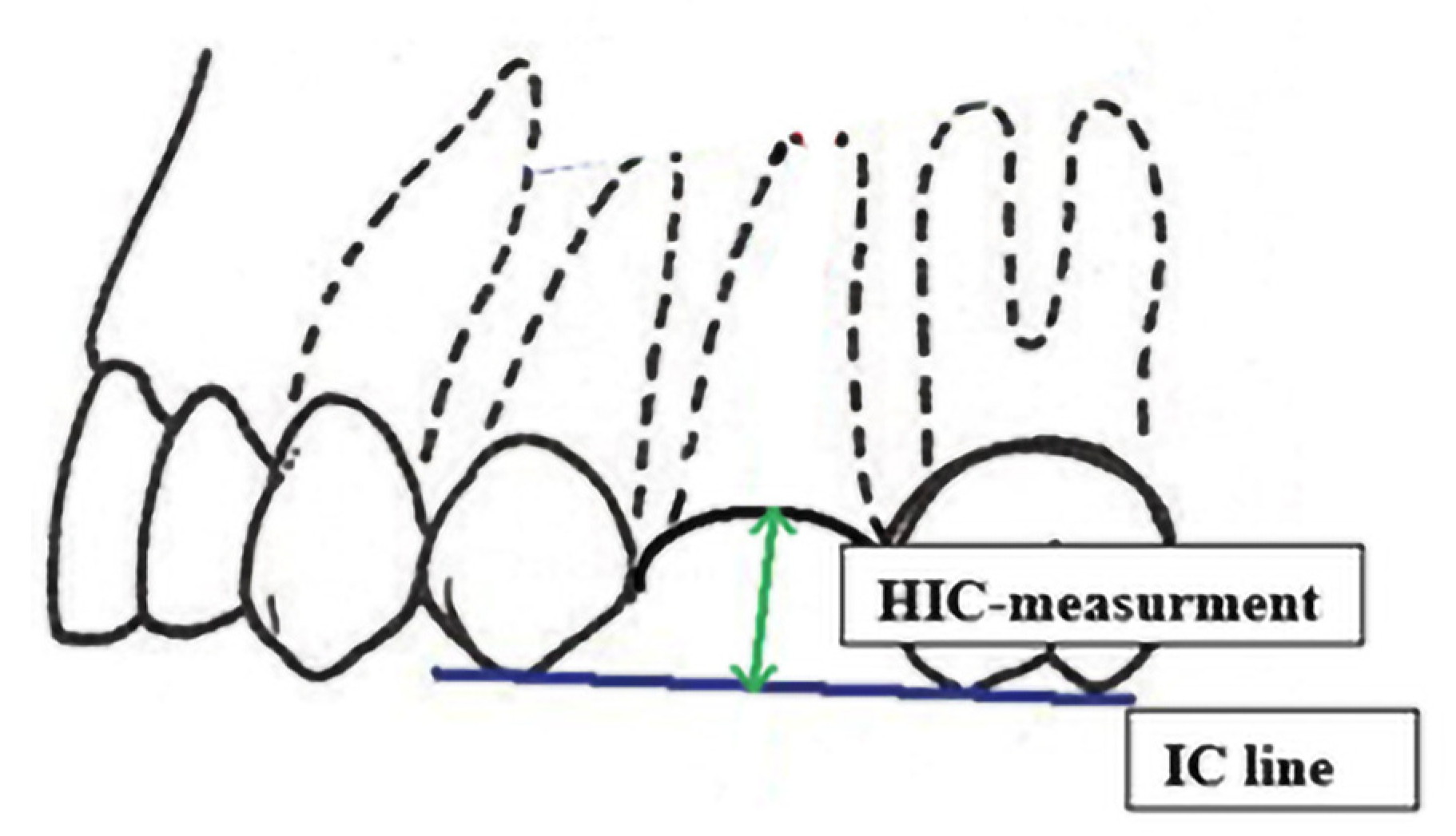 Coatings 12 00247 g004