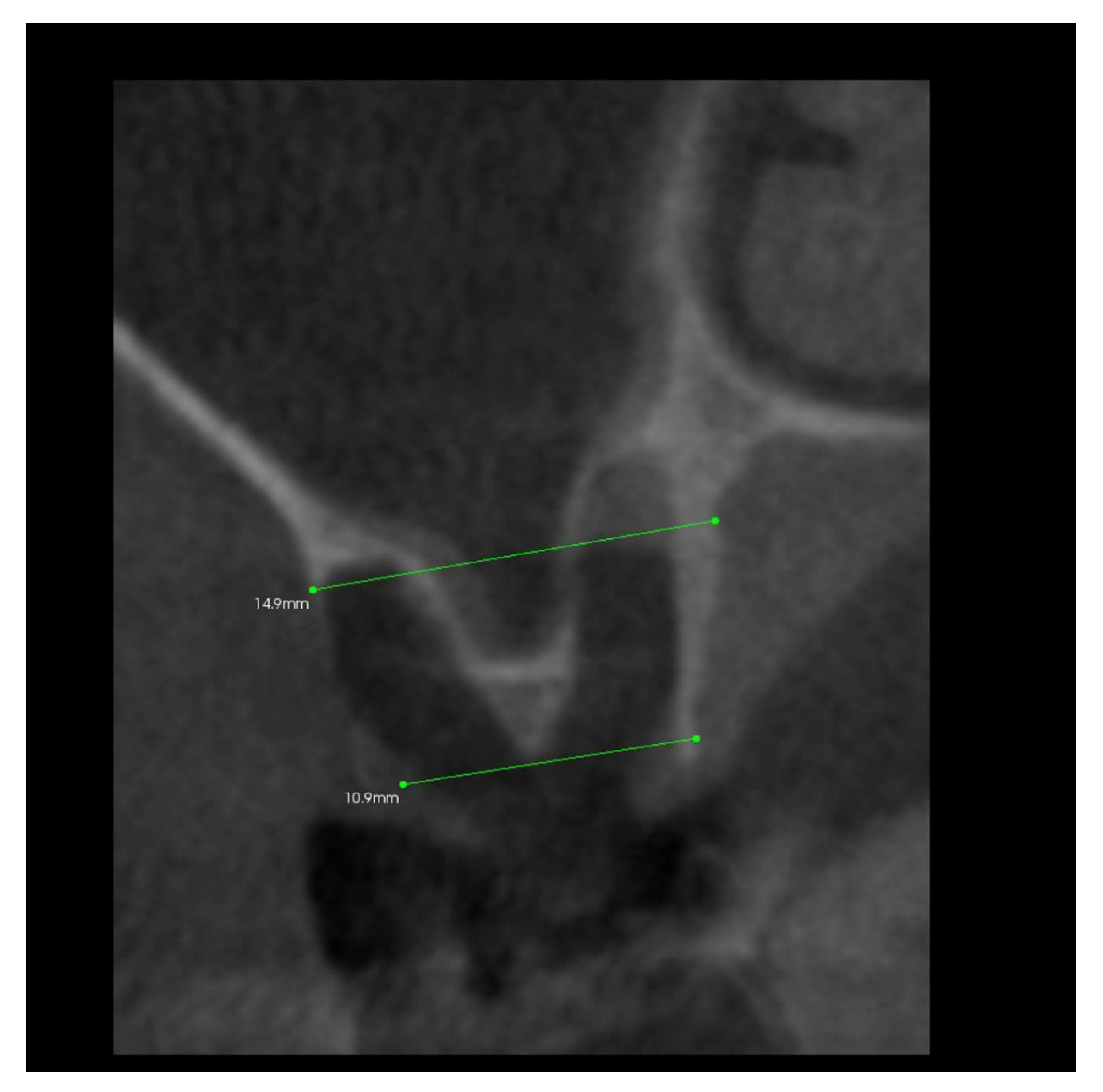 Coatings 12 00247 g005