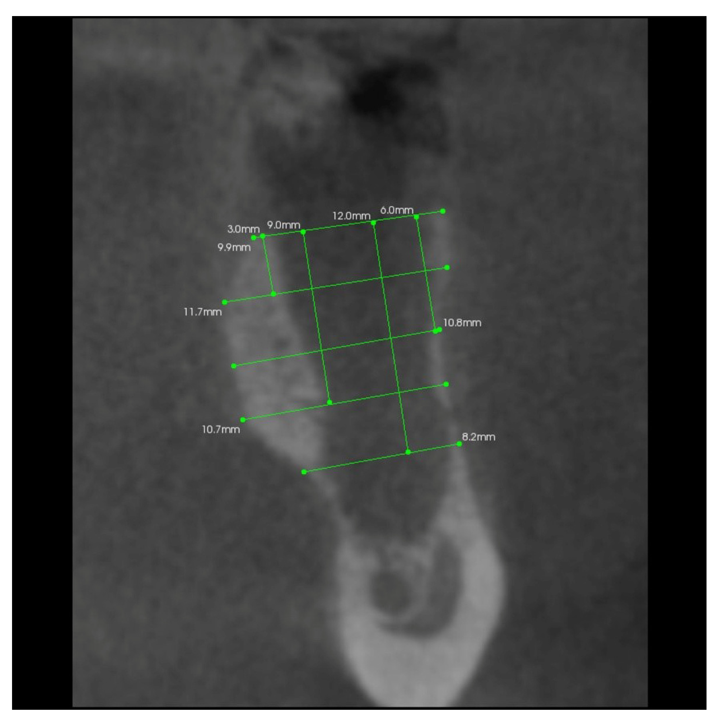 Coatings 12 00247 g007
